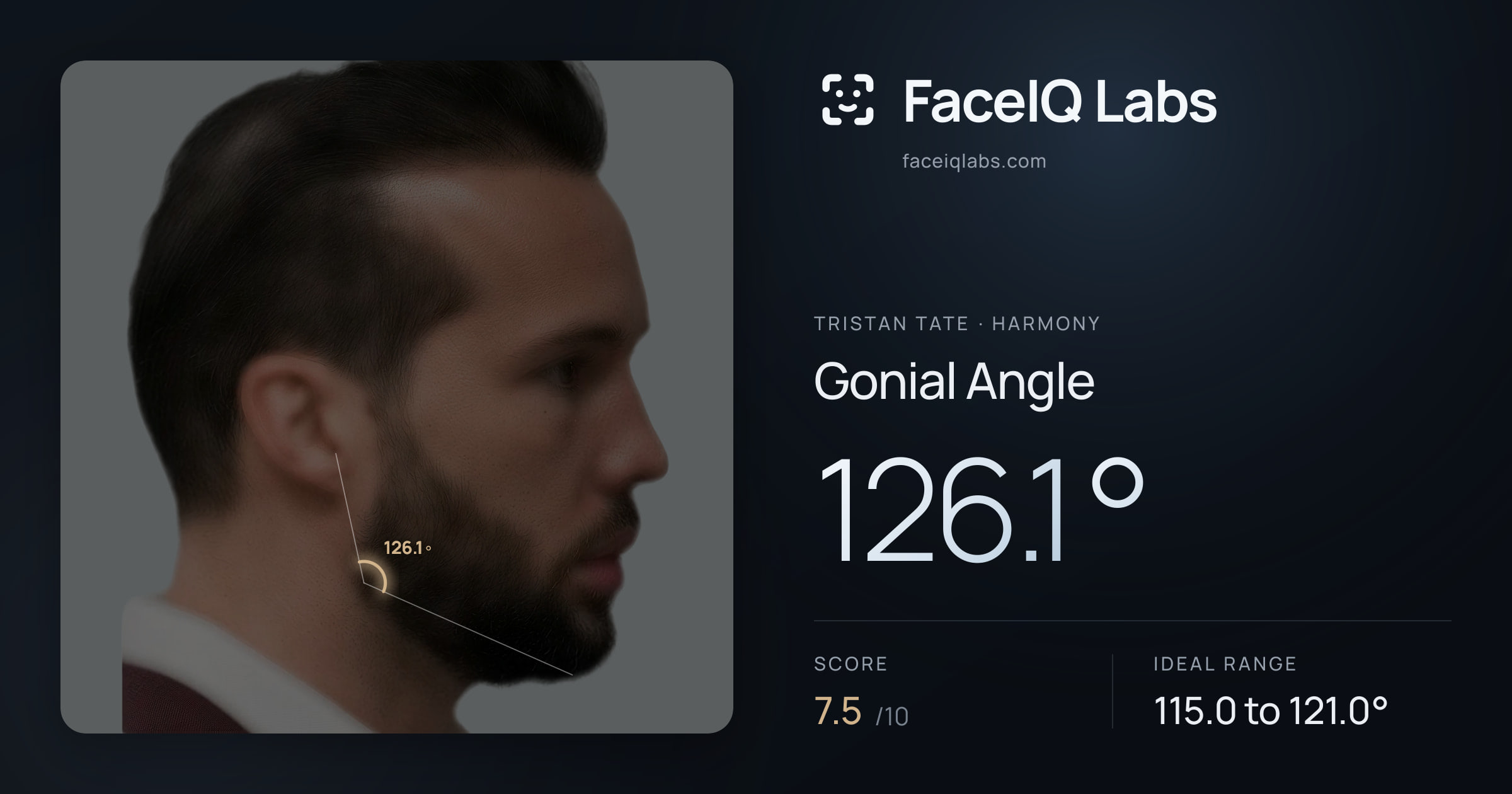 Tristan Tate Gonial Angle: 126.1°, drawn on the photo