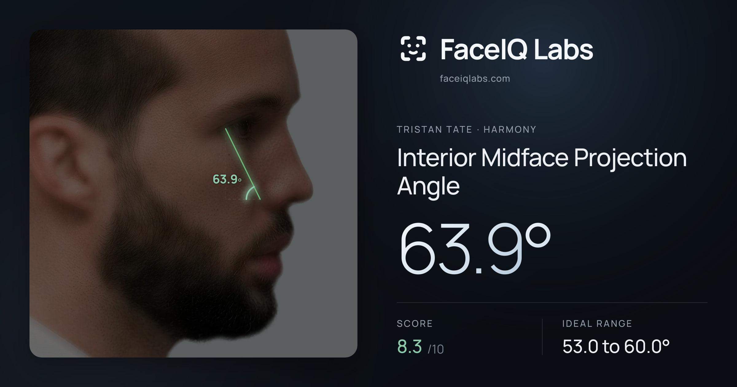 Tristan Tate Interior Midface Projection Angle: 63.9°, drawn on the photo