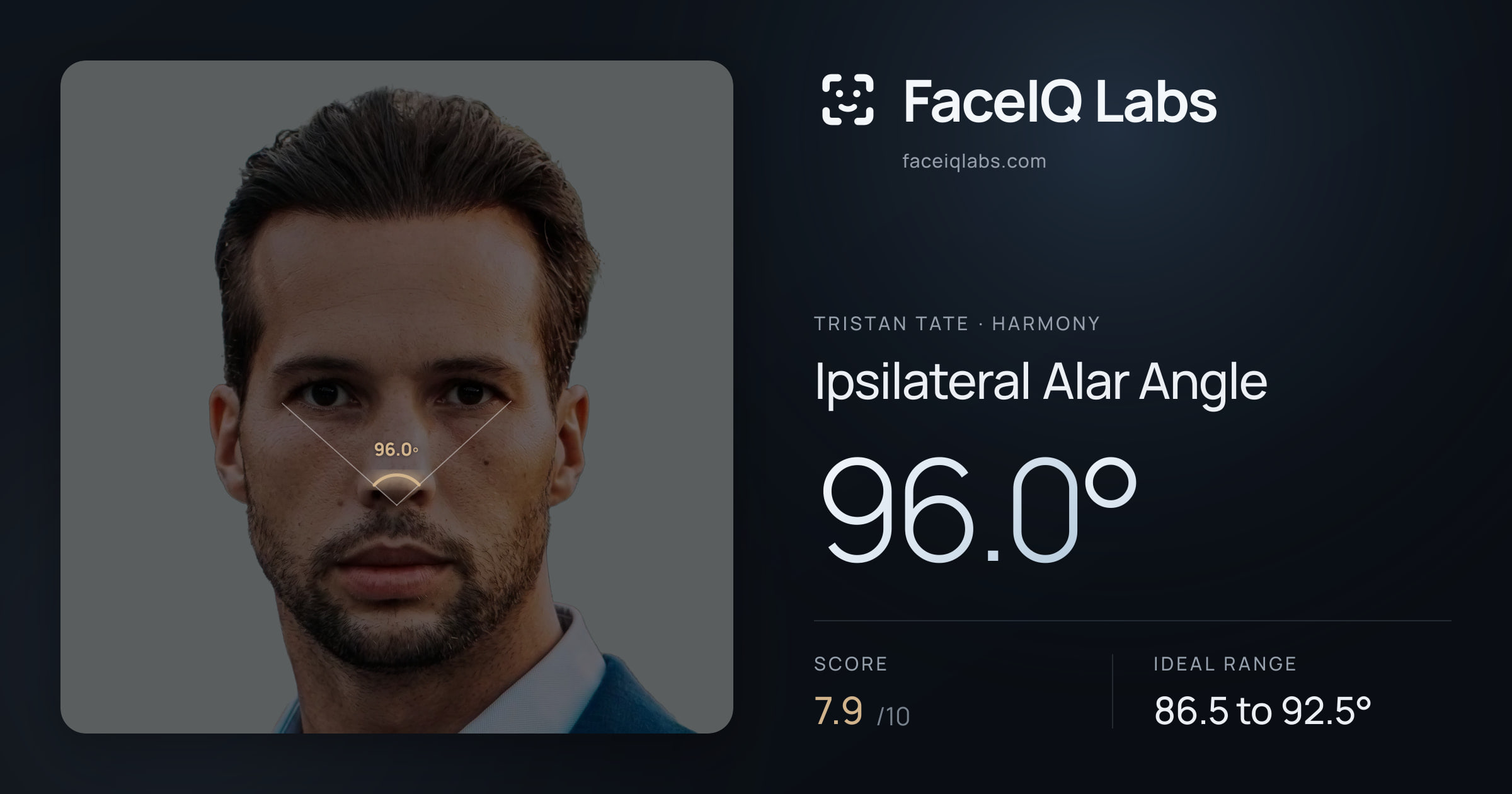 Tristan Tate Ipsilateral Alar Angle: 96.0°, drawn on the photo