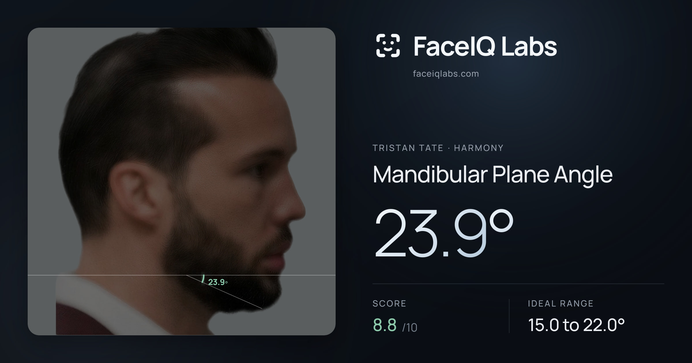 Tristan Tate Mandibular Plane Angle: 23.9°, drawn on the photo