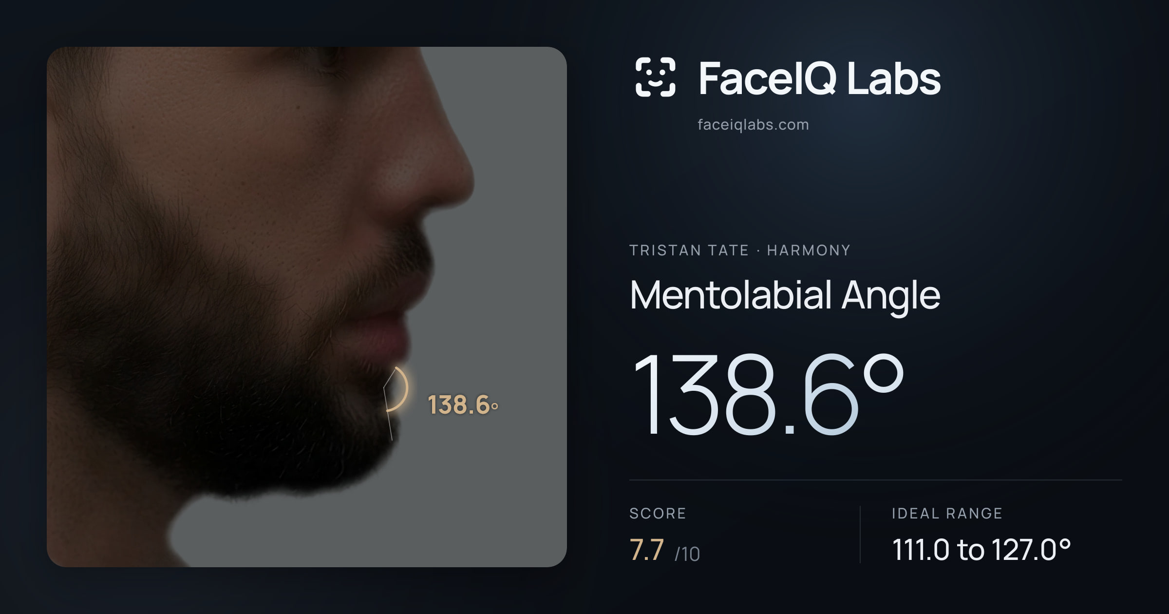 Tristan Tate Mentolabial Angle: 138.6°, drawn on the photo