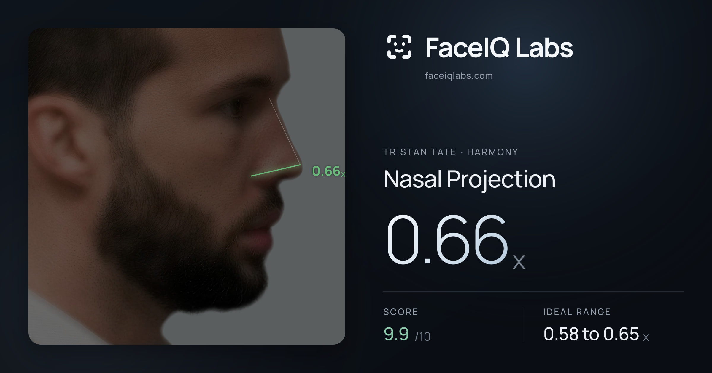 Tristan Tate Nasal Projection: 0.66x, drawn on the photo