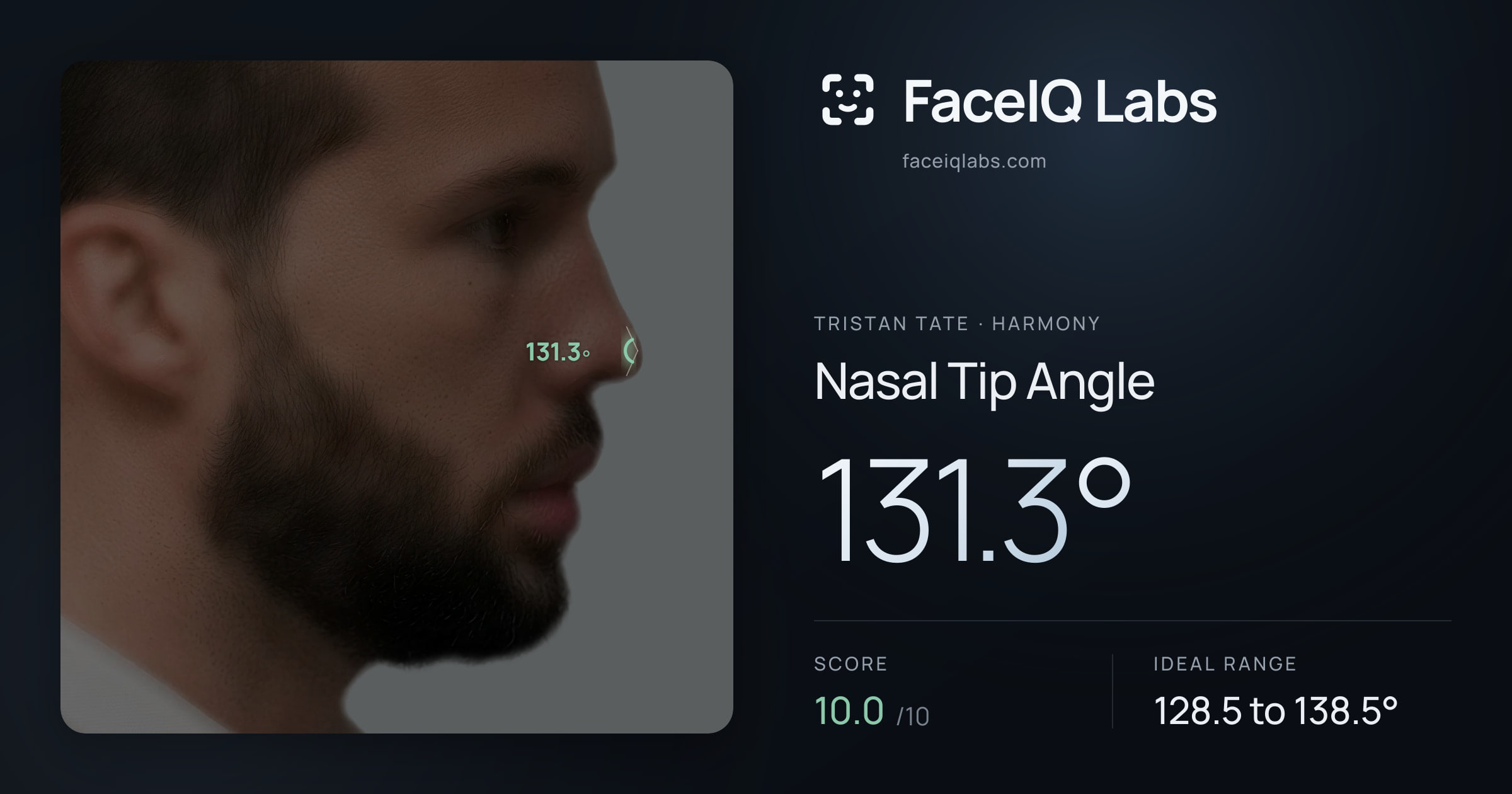 Tristan Tate Nasal Tip Angle: 131.3°, drawn on the photo