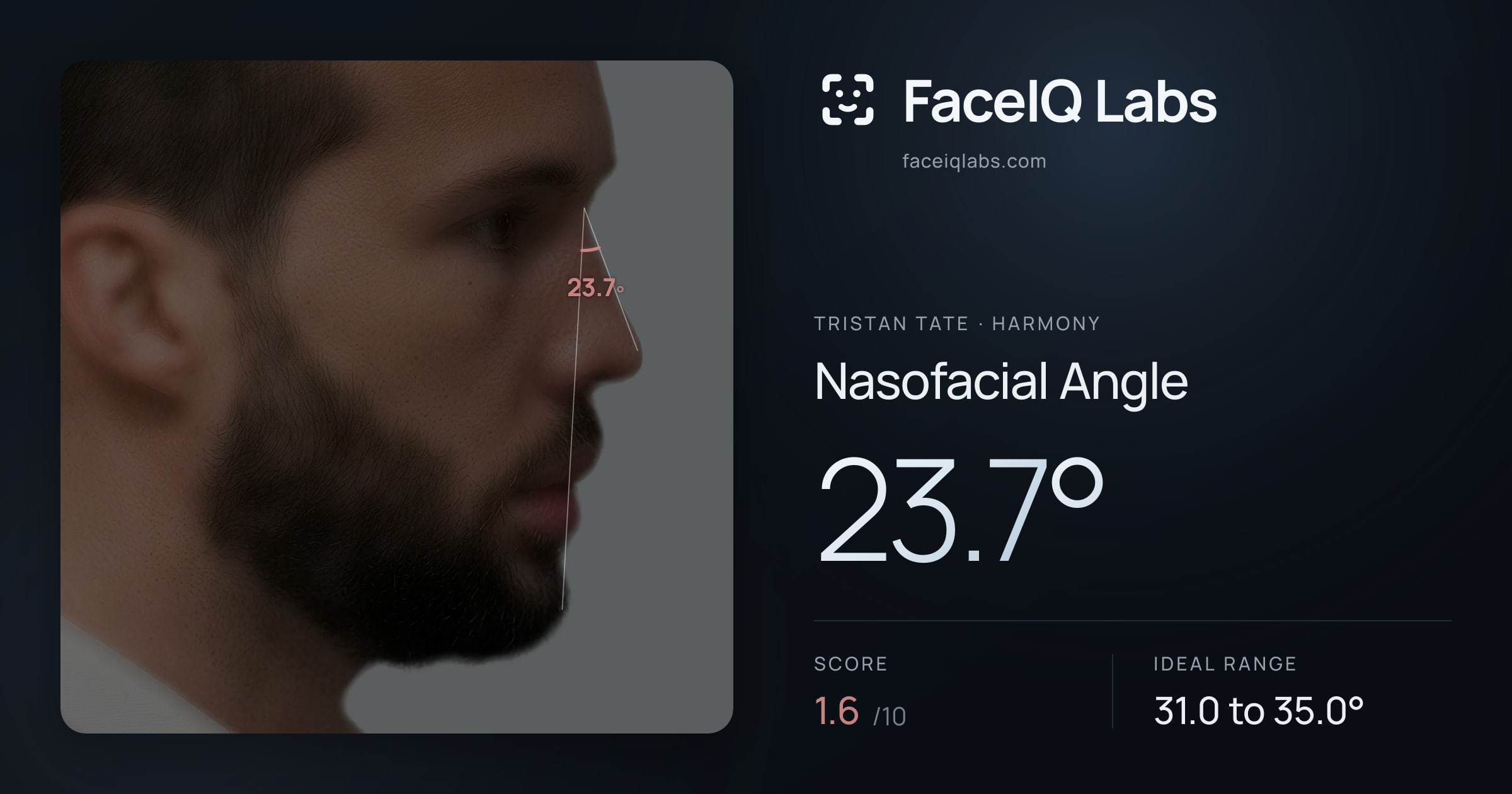 Tristan Tate Nasofacial Angle: 23.7°, drawn on the photo