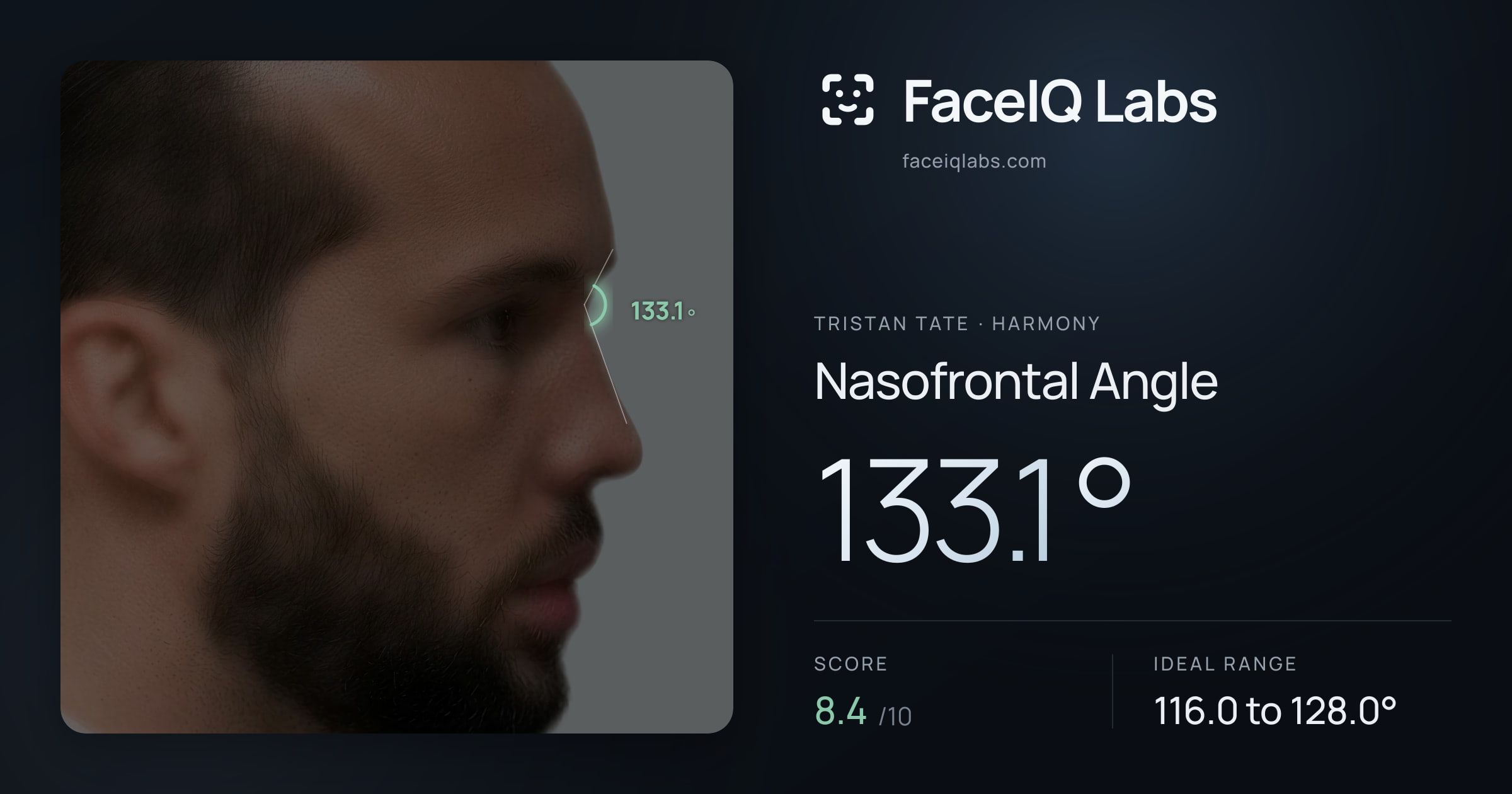 Tristan Tate Nasofrontal Angle: 133.1°, drawn on the photo