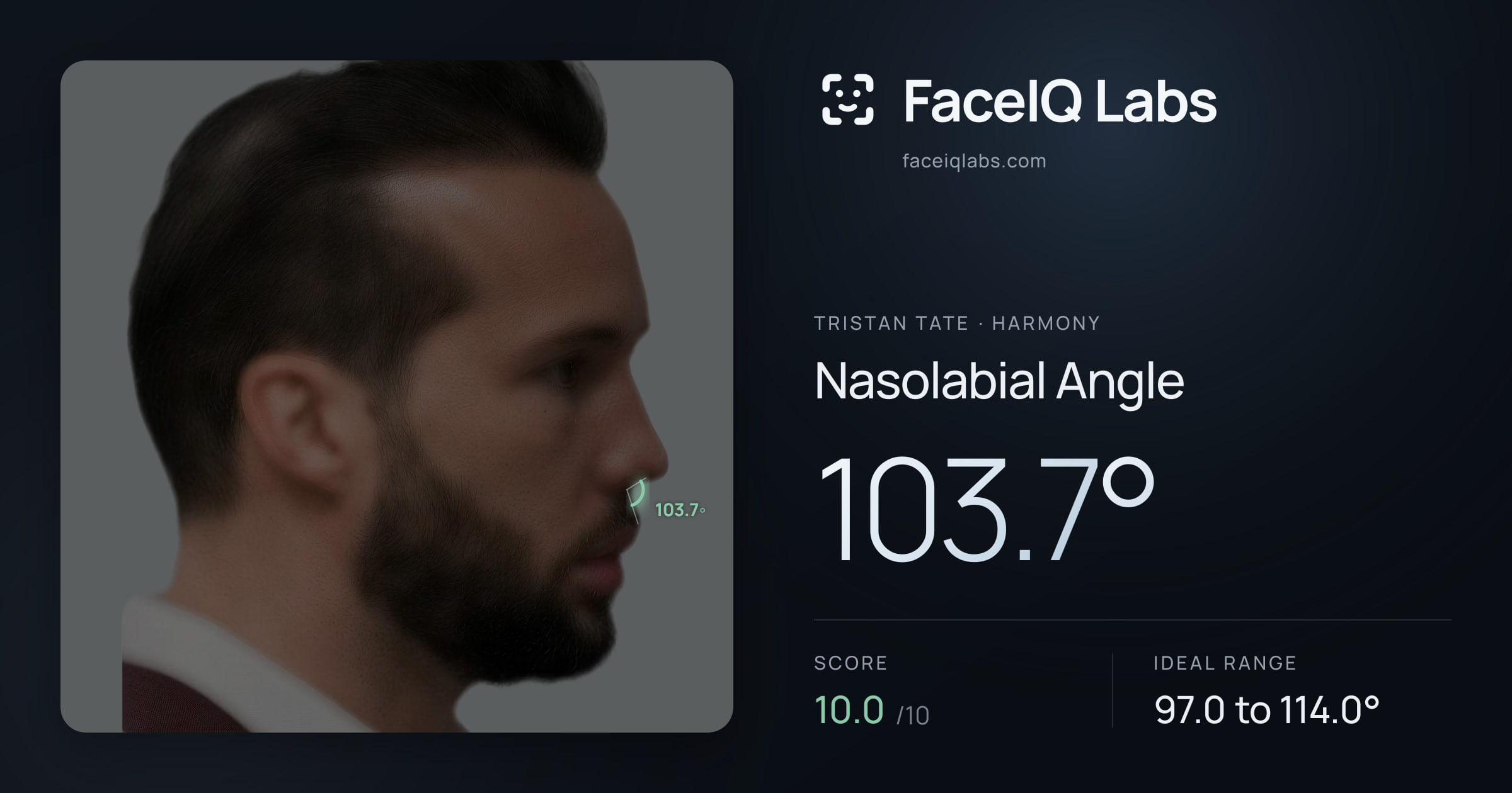 Tristan Tate Nasolabial Angle: 103.7°, drawn on the photo
