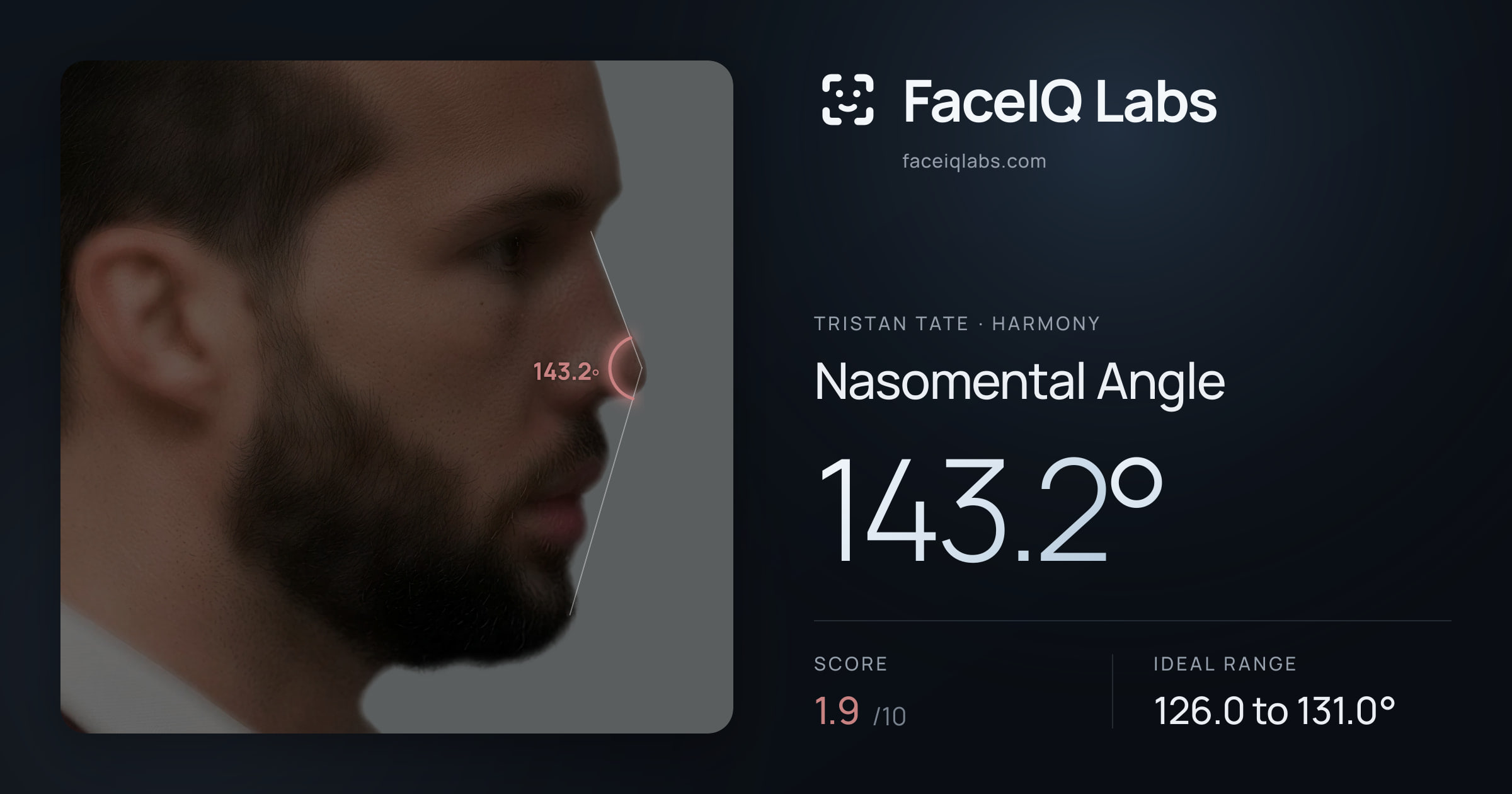 Tristan Tate Nasomental Angle: 143.2°, drawn on the photo