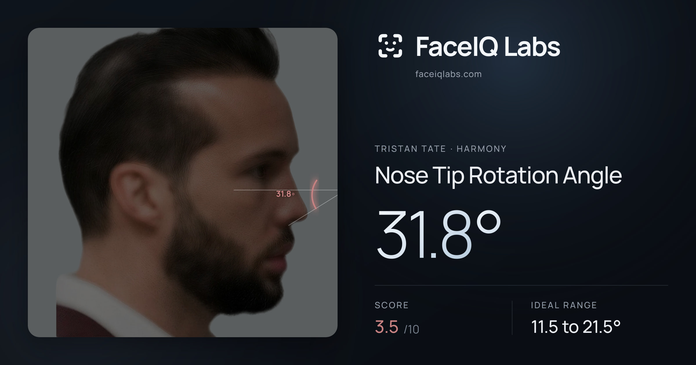 Tristan Tate Nose Tip Rotation Angle: 31.8°, drawn on the photo
