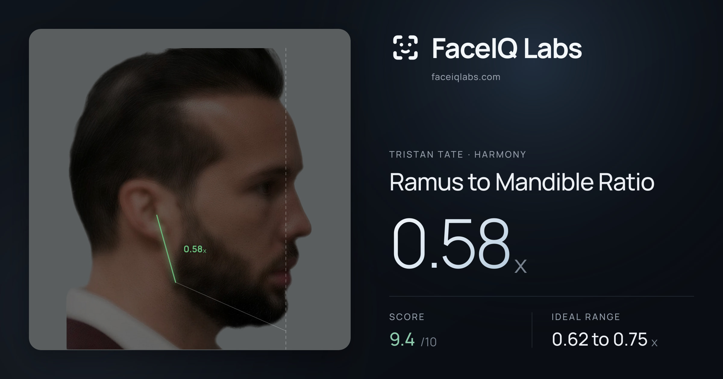 Tristan Tate Ramus to Mandible Ratio: 0.58x, drawn on the photo