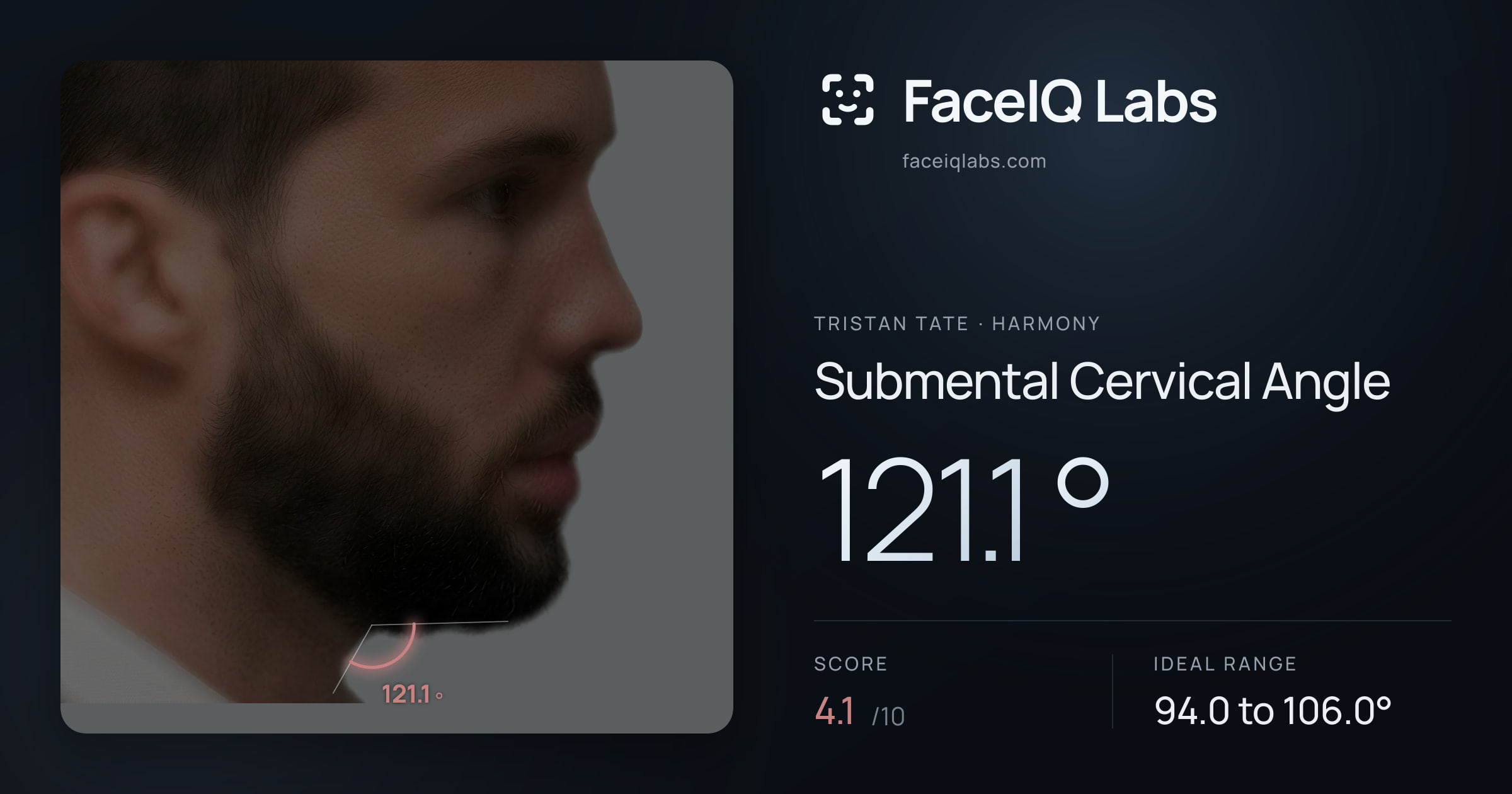 Tristan Tate Submental Cervical Angle: 121.1°, drawn on the photo