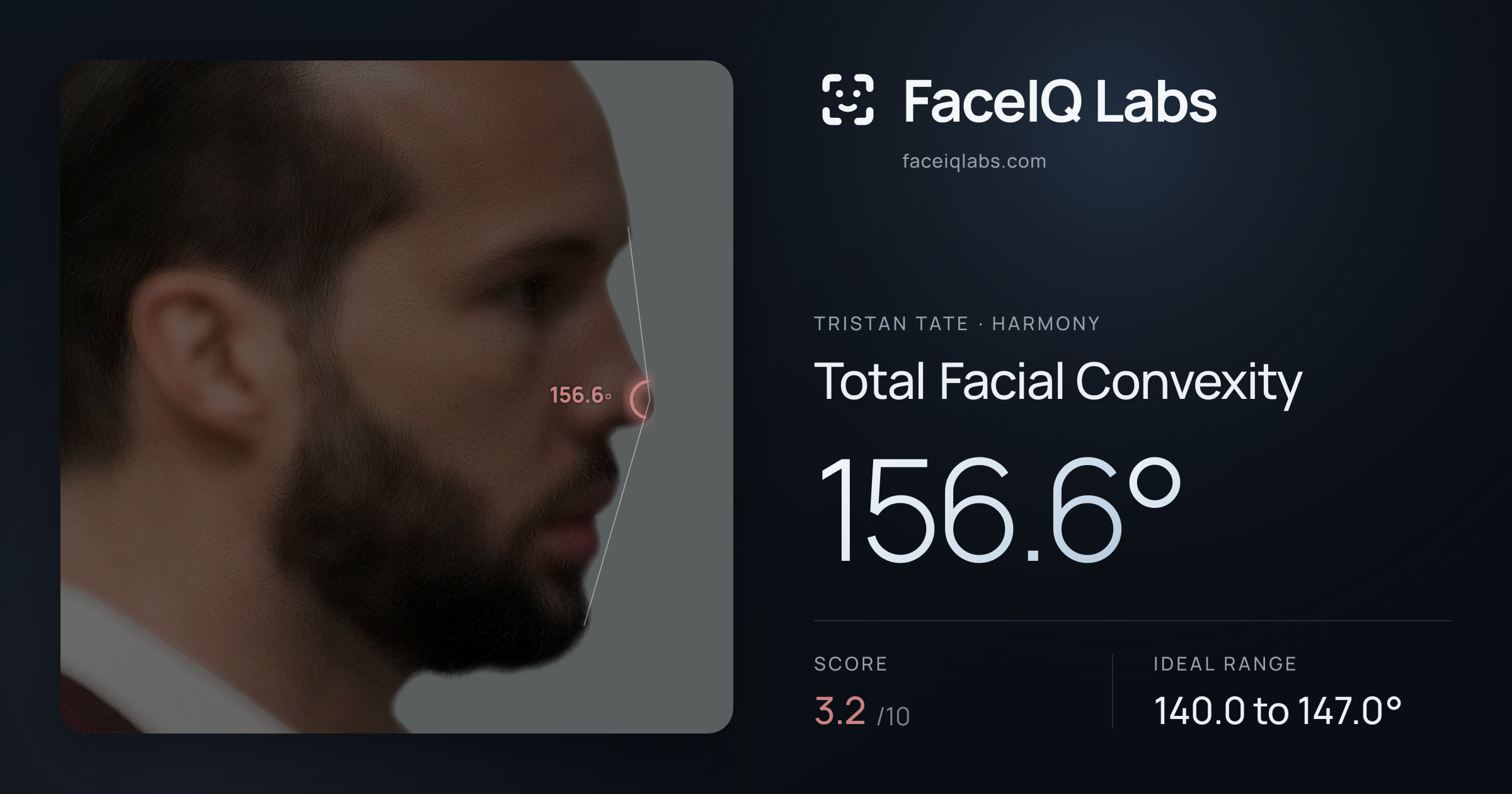 Tristan Tate Total Facial Convexity: 156.6°, drawn on the photo
