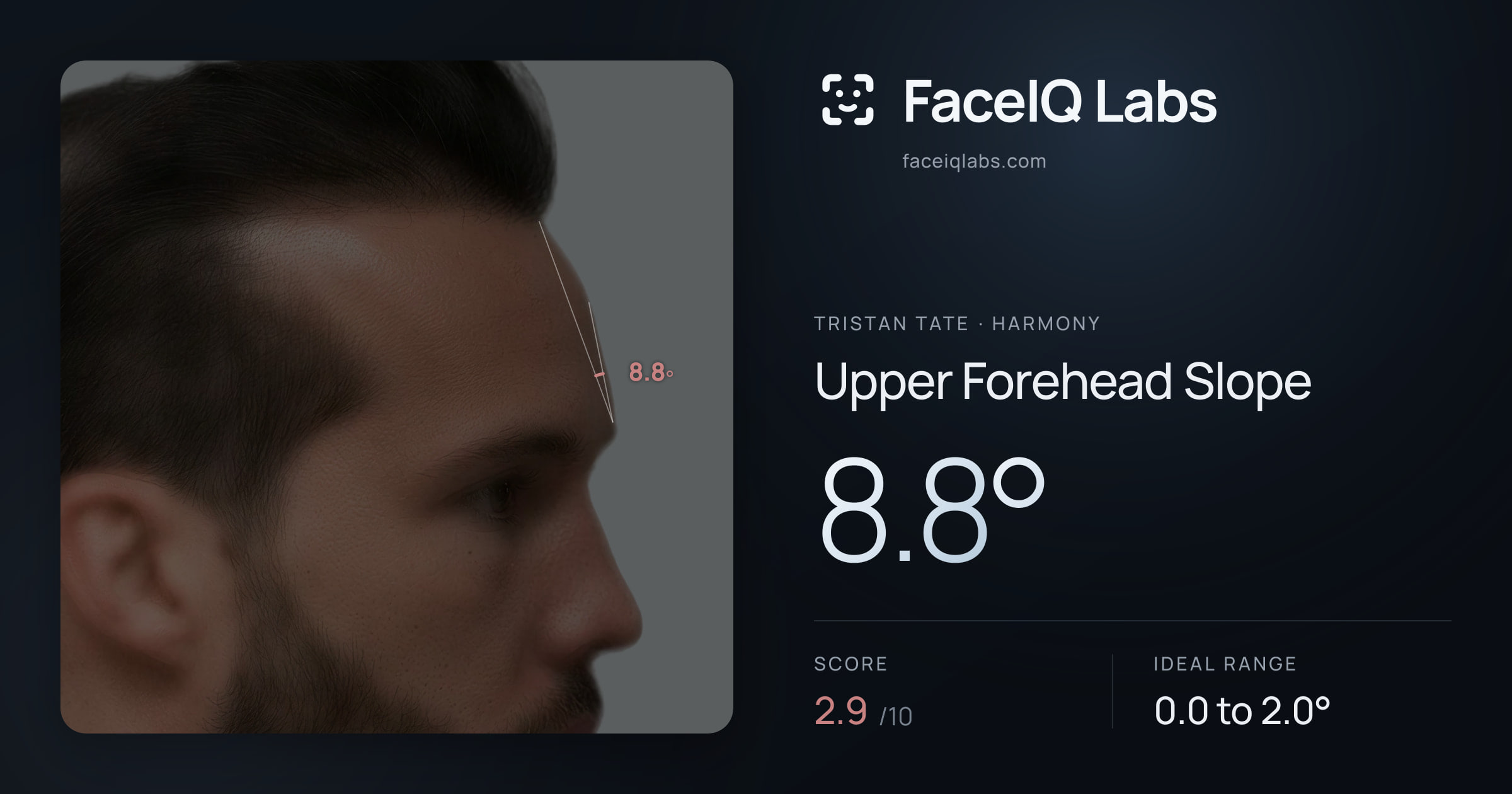 Tristan Tate Upper Forehead Slope: 8.8°, drawn on the photo