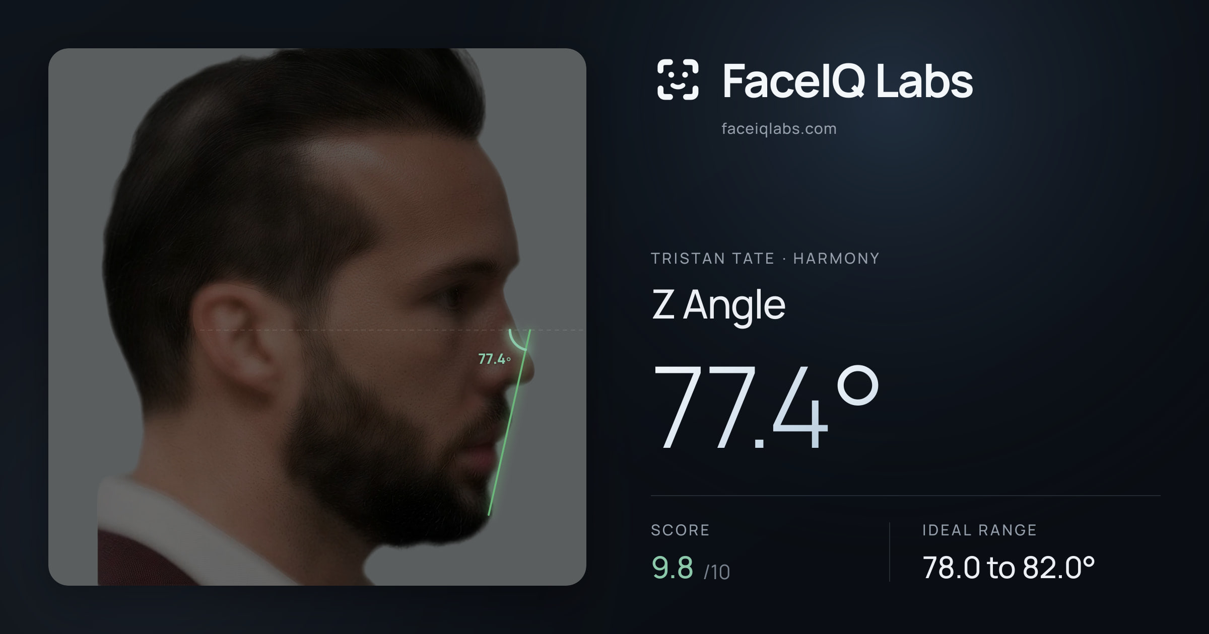 Tristan Tate Z Angle: 77.4°, drawn on the photo
