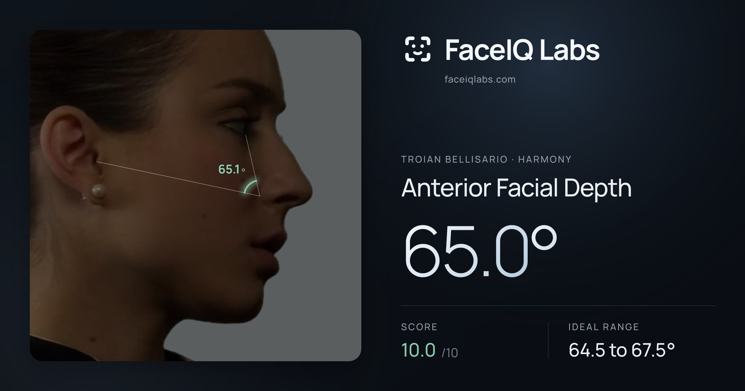 Troian Bellisario Anterior Facial Depth: 65.0°, drawn on the photo