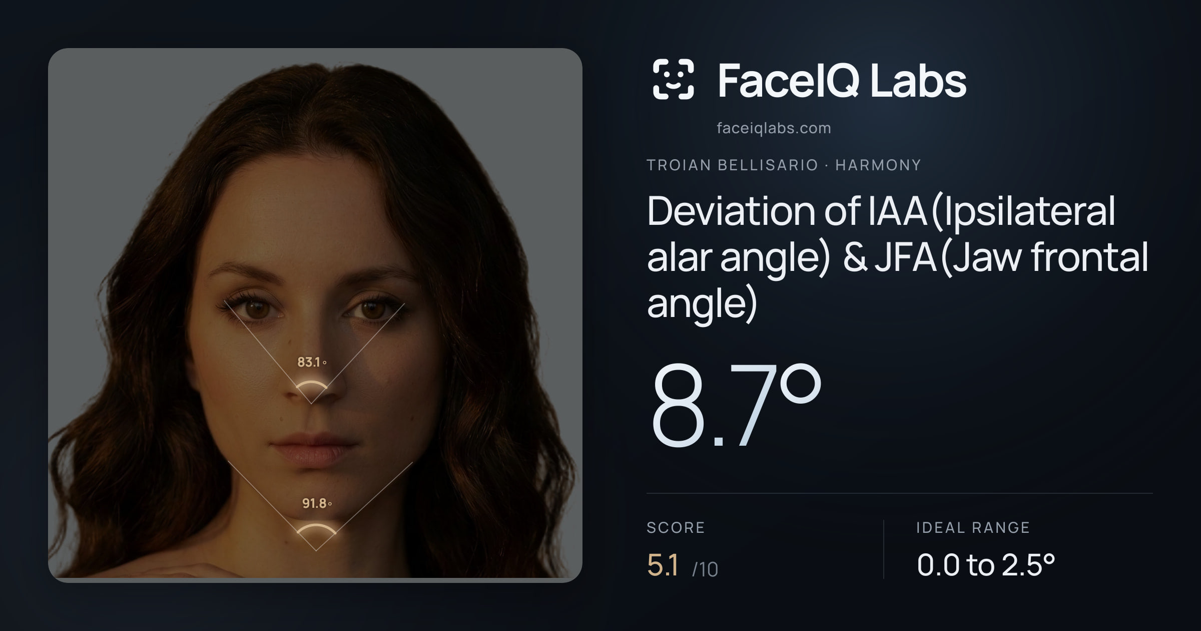 Troian Bellisario Deviation of IAA(Ipsilateral alar angle) & JFA(Jaw frontal angle): 8.7°, drawn on the photo
