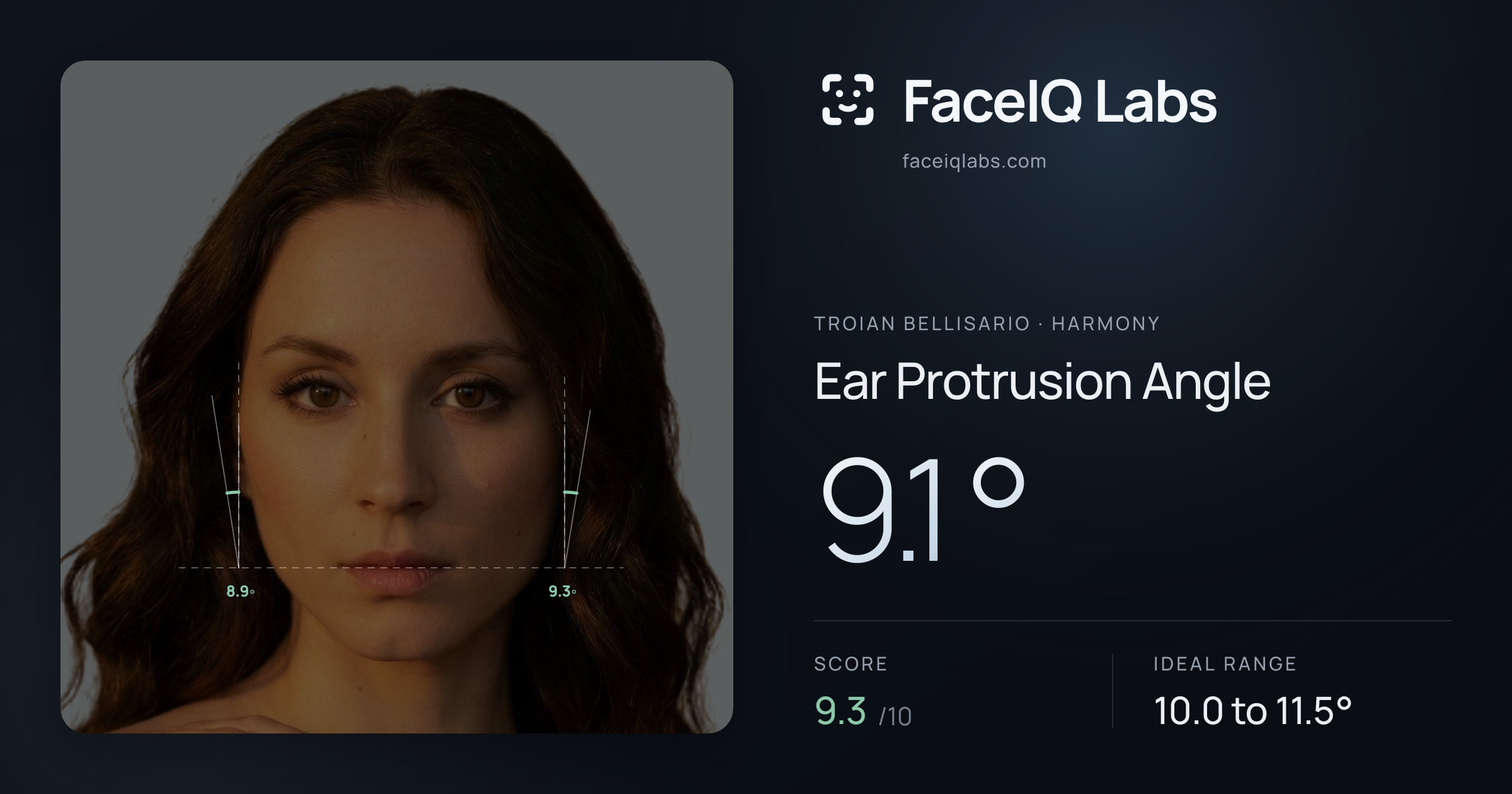 Troian Bellisario Ear Protrusion Angle: 9.1°, drawn on the photo