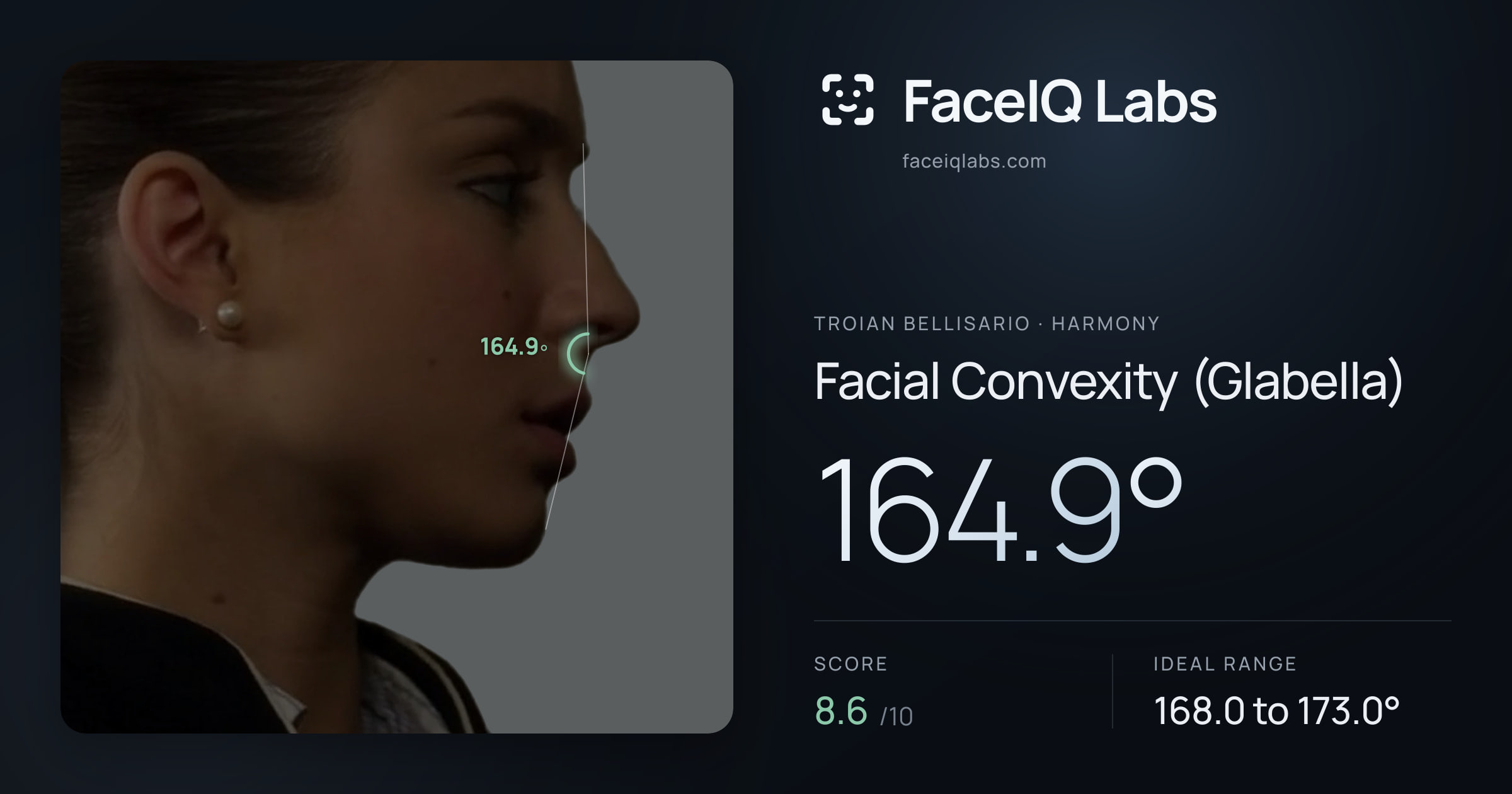 Troian Bellisario Facial Convexity (Glabella): 164.9°, drawn on the photo