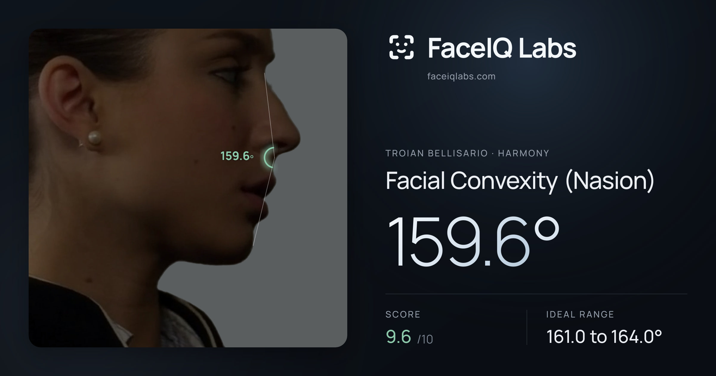 Troian Bellisario Facial Convexity (Nasion): 159.6°, drawn on the photo