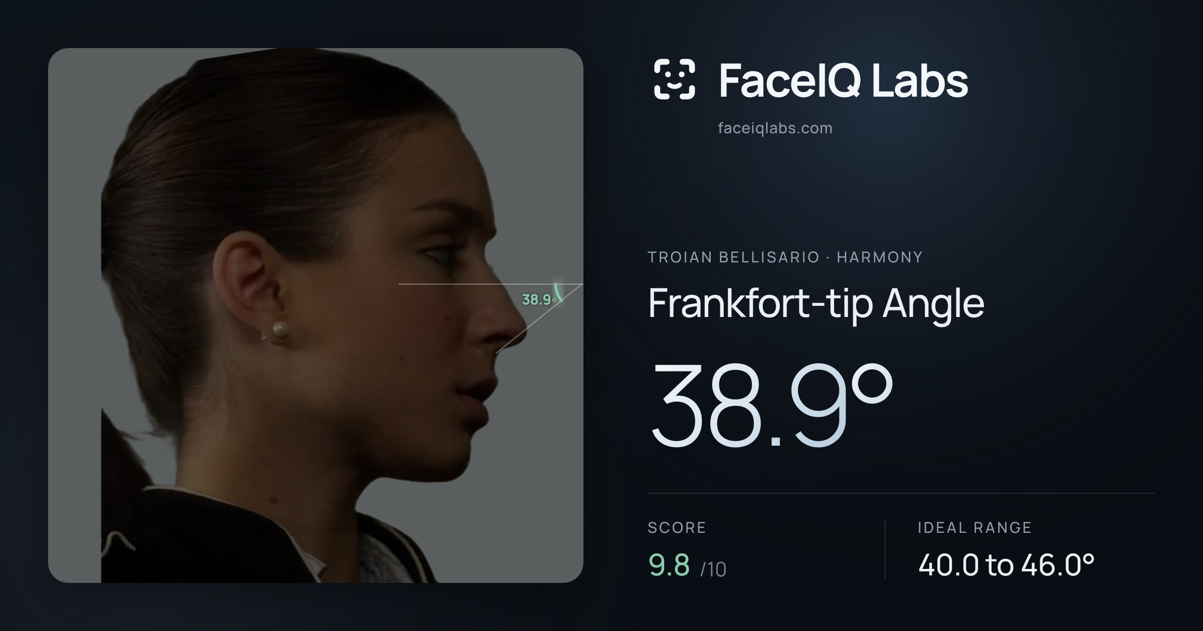 Troian Bellisario Frankfort-tip Angle: 38.9°, drawn on the photo