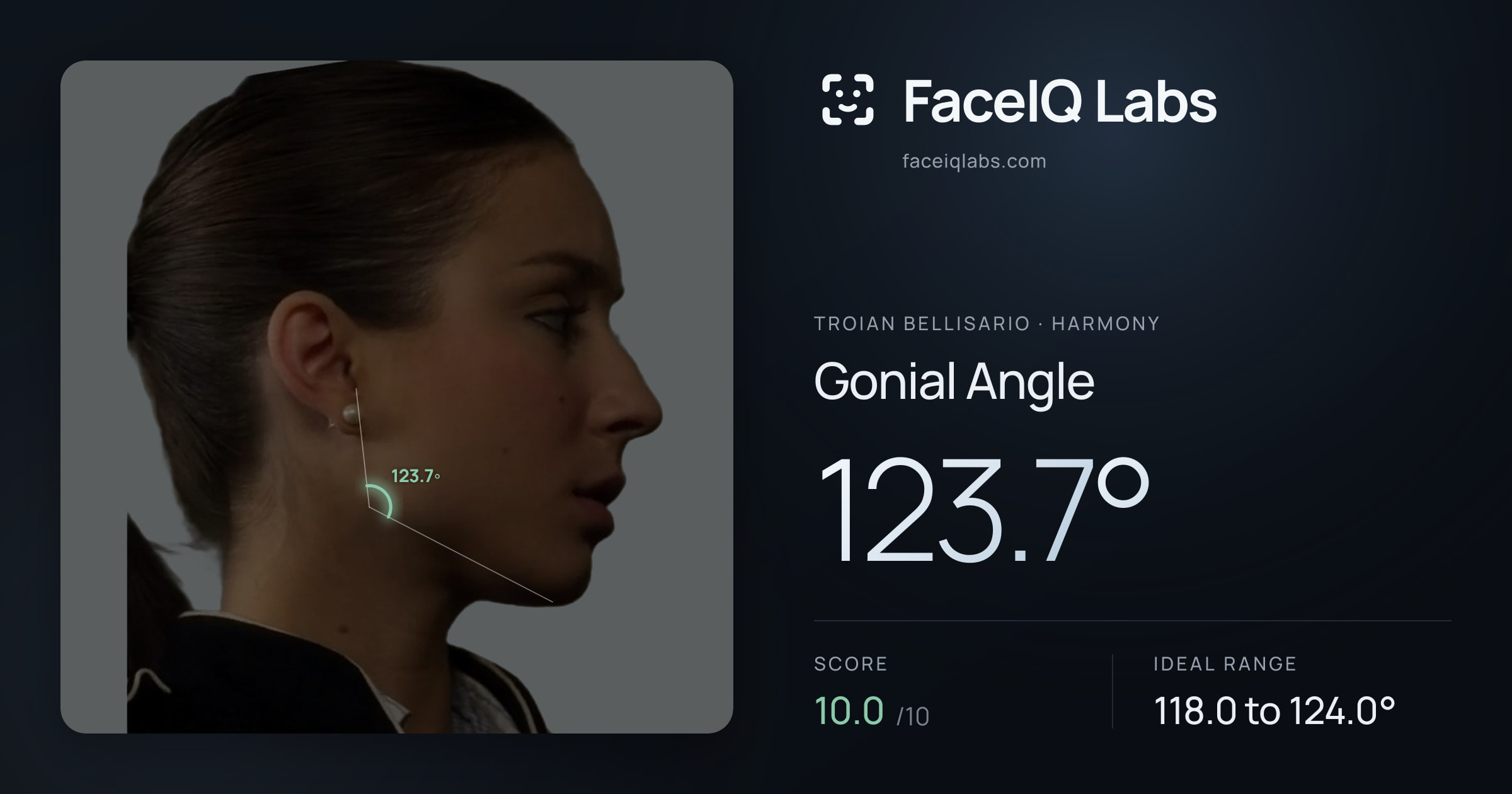 Troian Bellisario Gonial Angle: 123.7°, drawn on the photo