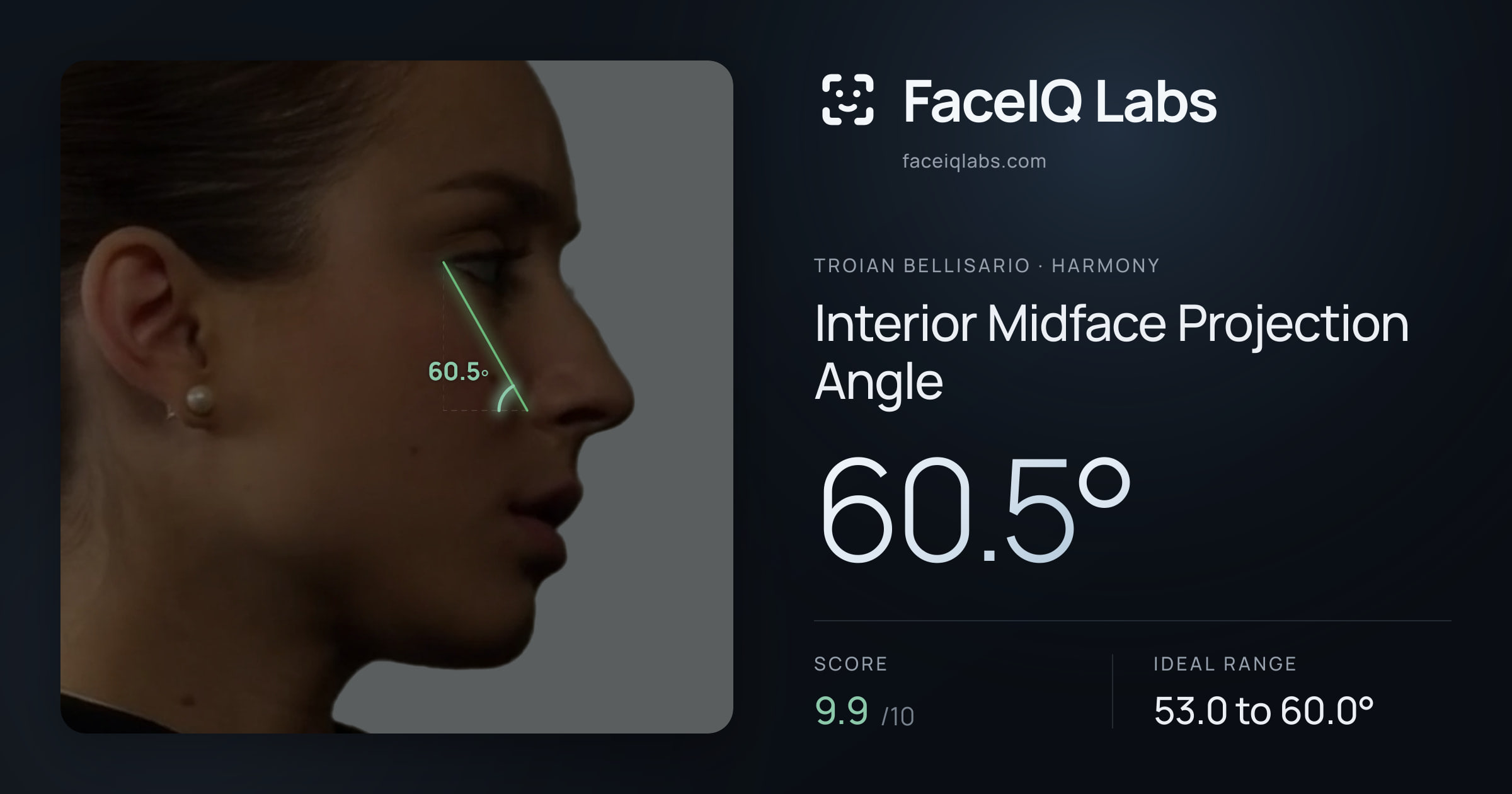 Troian Bellisario Interior Midface Projection Angle: 60.5°, drawn on the photo