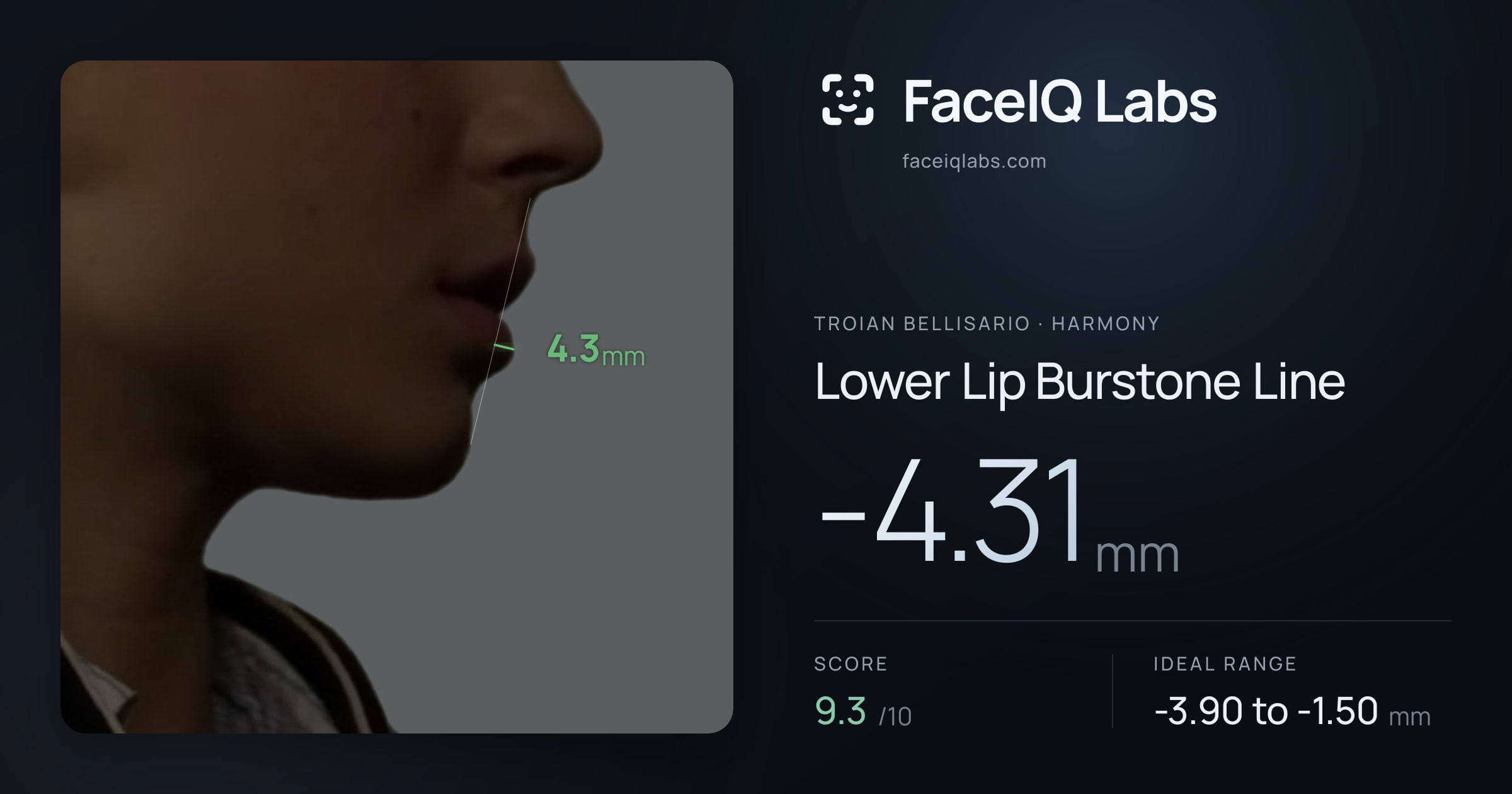 Troian Bellisario Lower Lip Burstone Line: -4.31mm, drawn on the photo