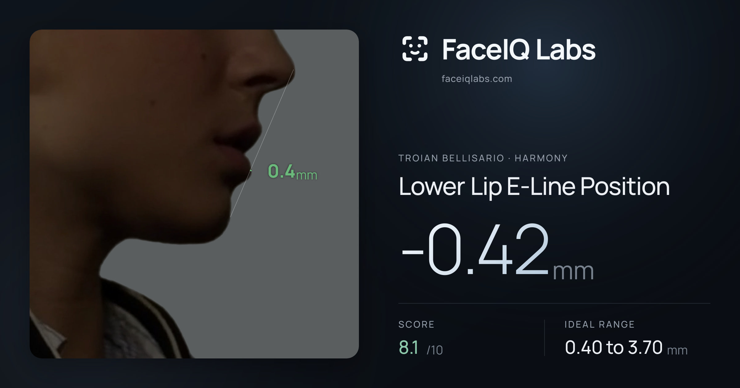 Troian Bellisario Lower Lip E-Line Position: -0.42mm, drawn on the photo