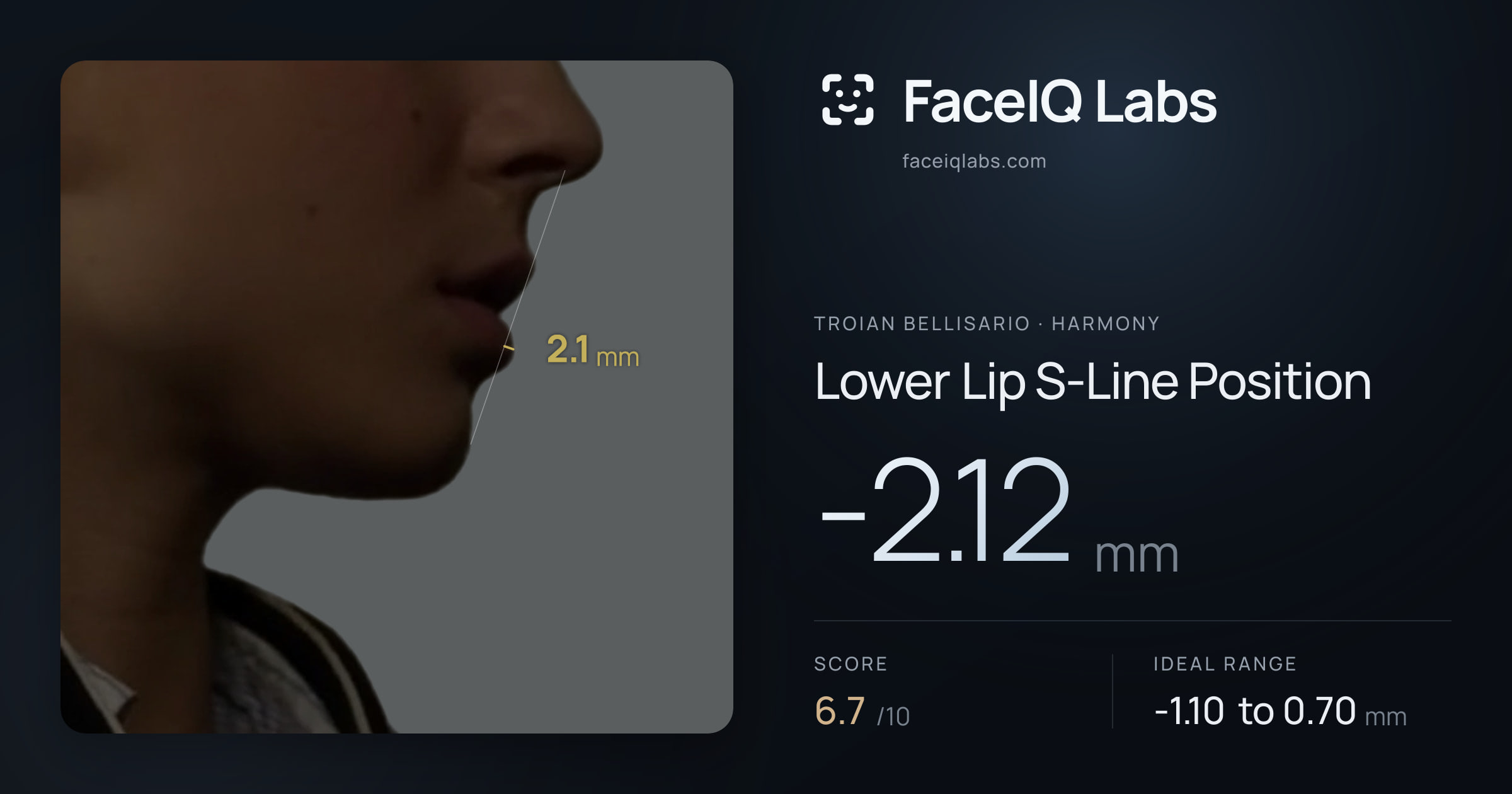 Troian Bellisario Lower Lip S-Line Position: -2.12mm, drawn on the photo