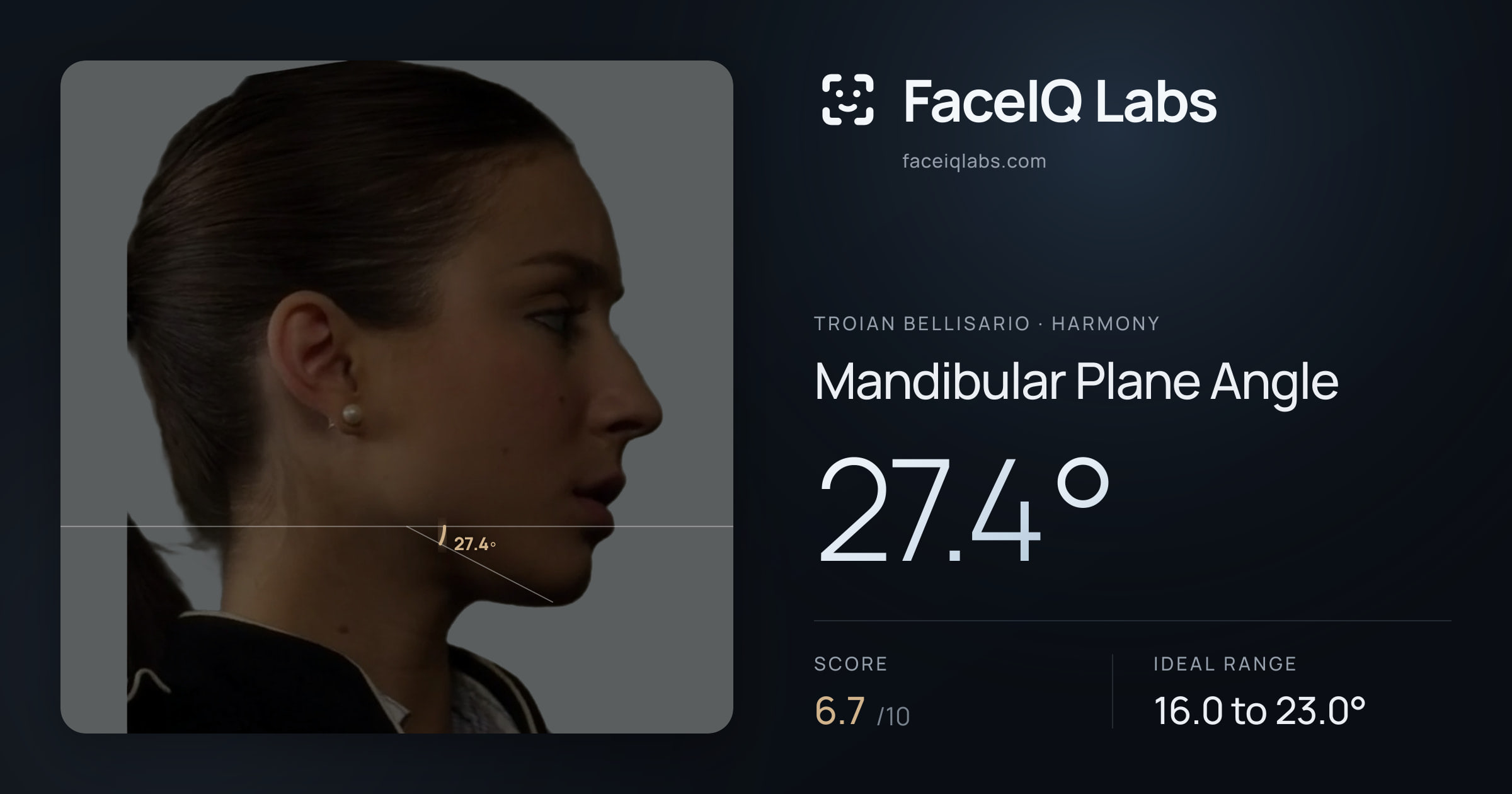 Troian Bellisario Mandibular Plane Angle: 27.4°, drawn on the photo