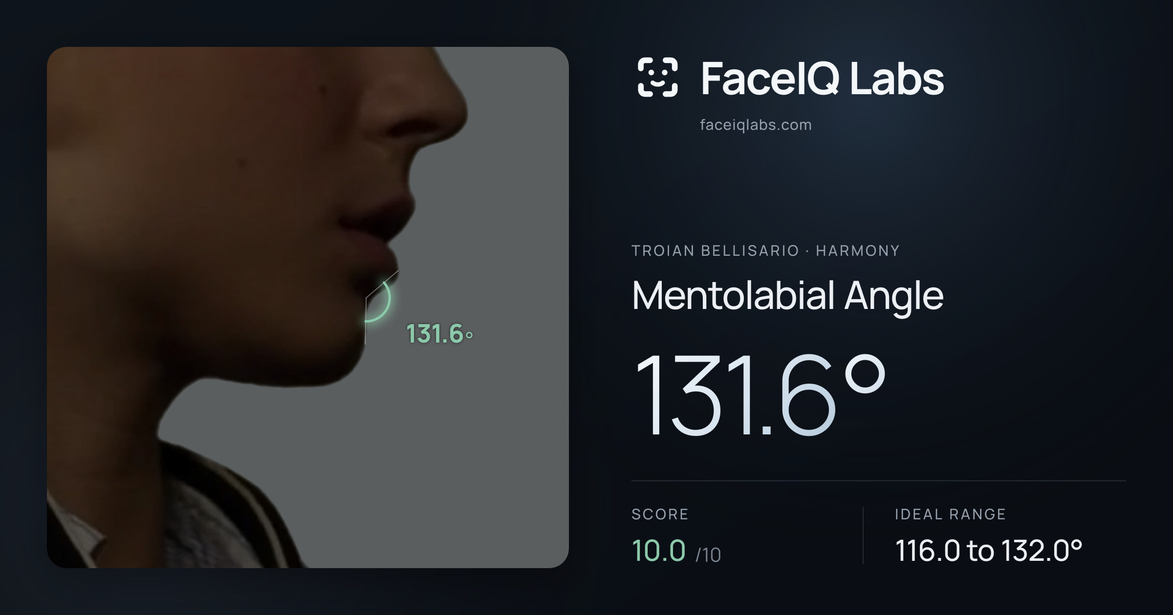 Troian Bellisario Mentolabial Angle: 131.6°, drawn on the photo