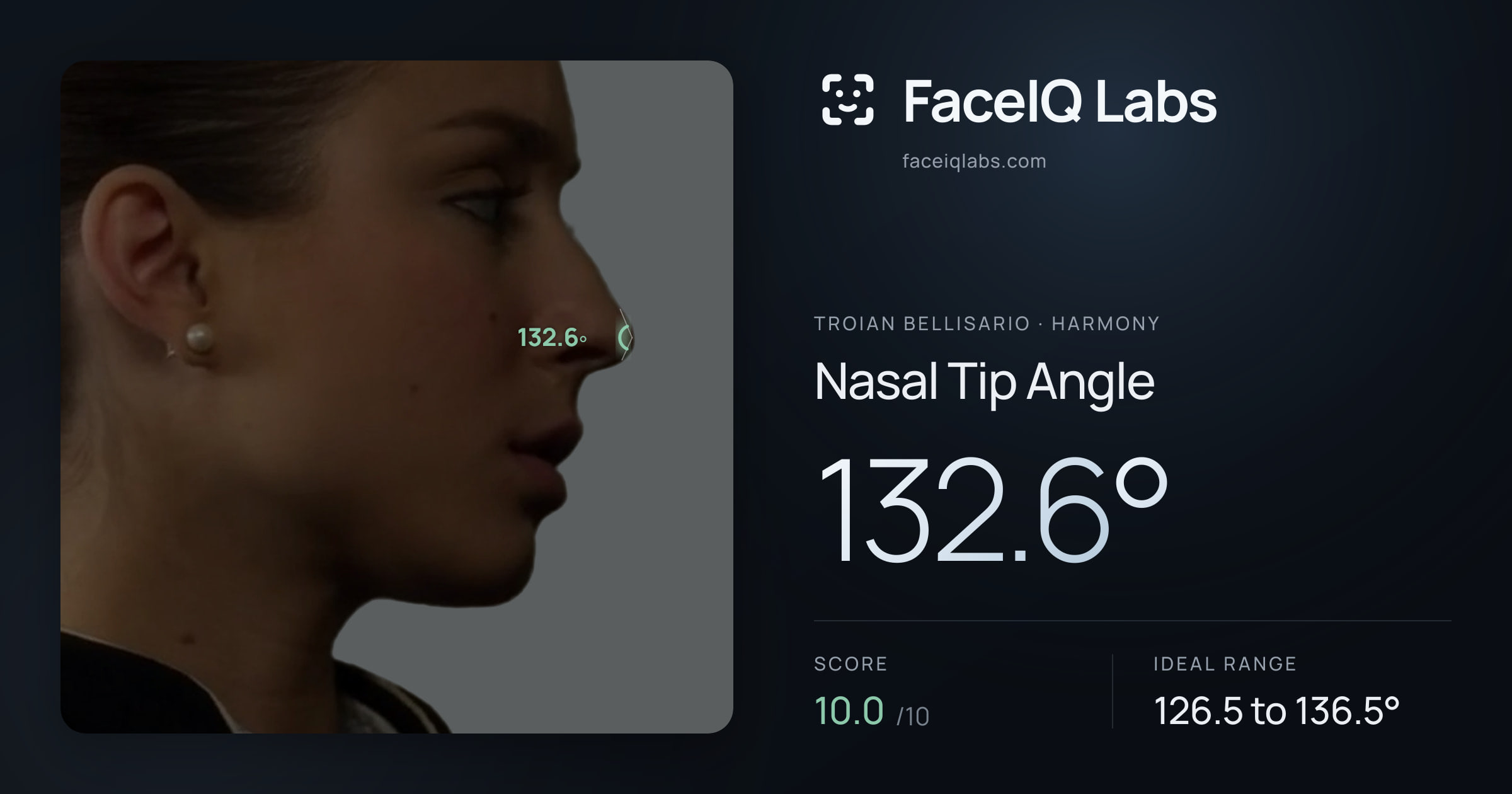 Troian Bellisario Nasal Tip Angle: 132.6°, drawn on the photo