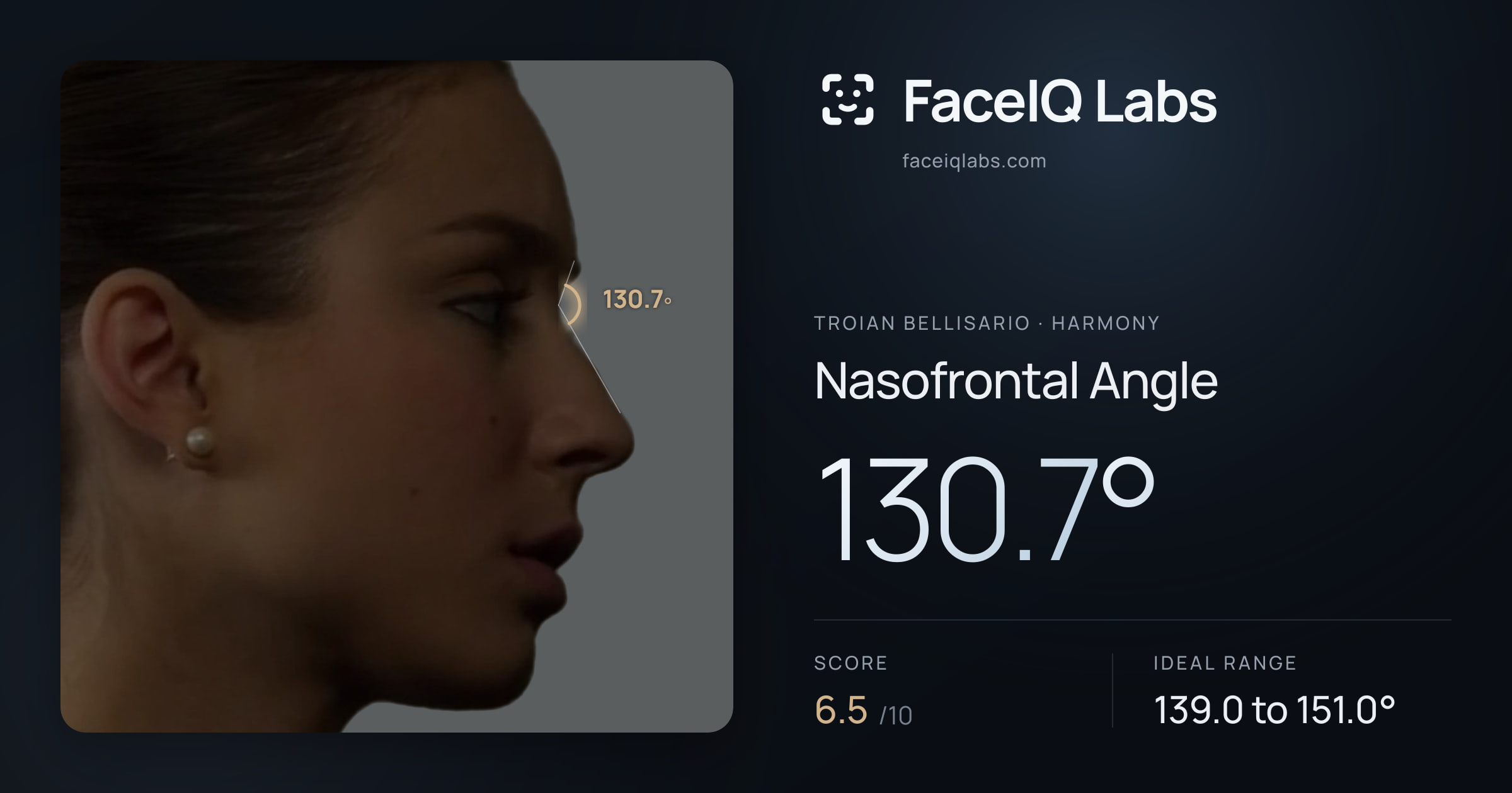Troian Bellisario Nasofrontal Angle: 130.7°, drawn on the photo