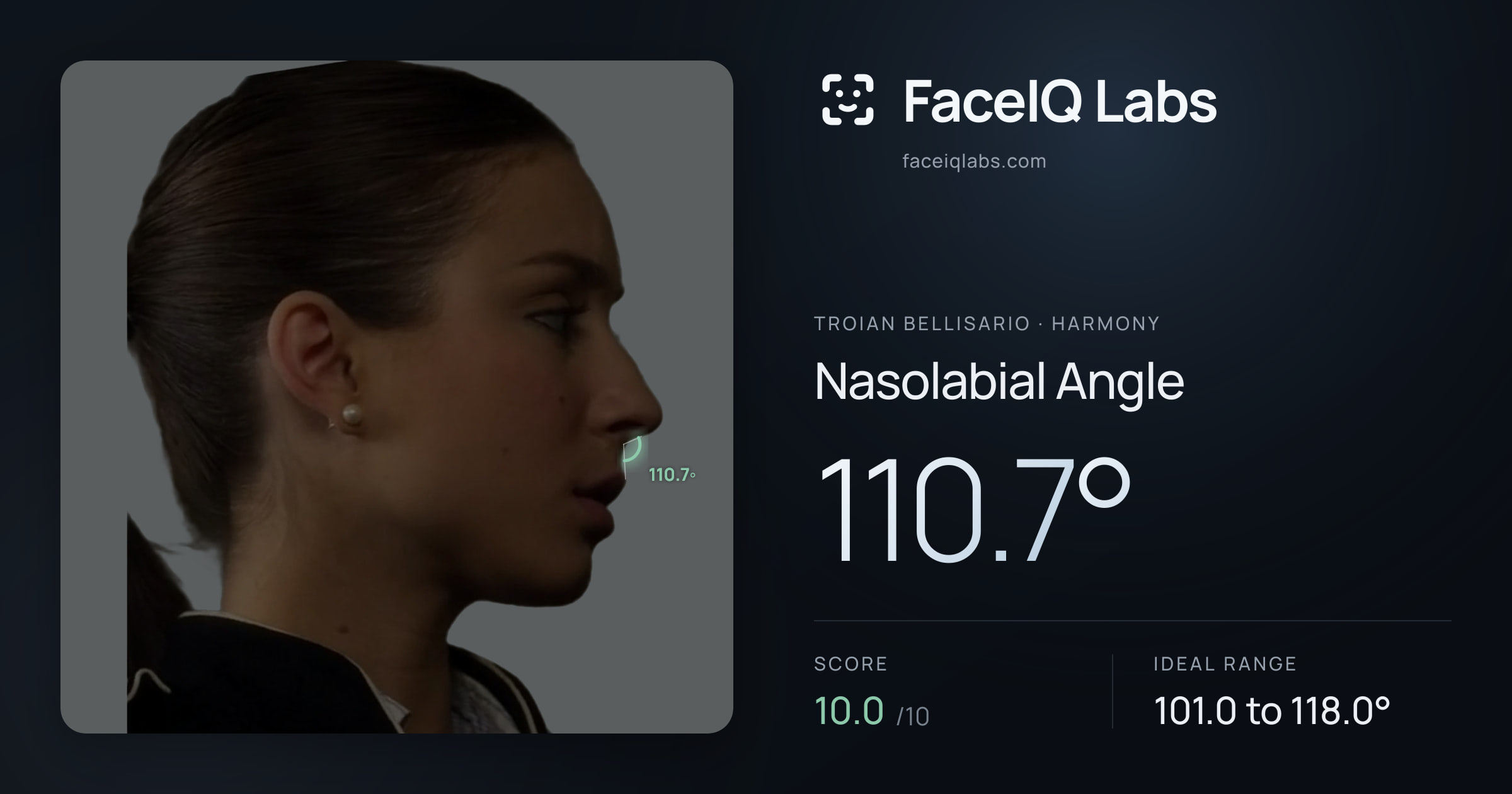 Troian Bellisario Nasolabial Angle: 110.7°, drawn on the photo