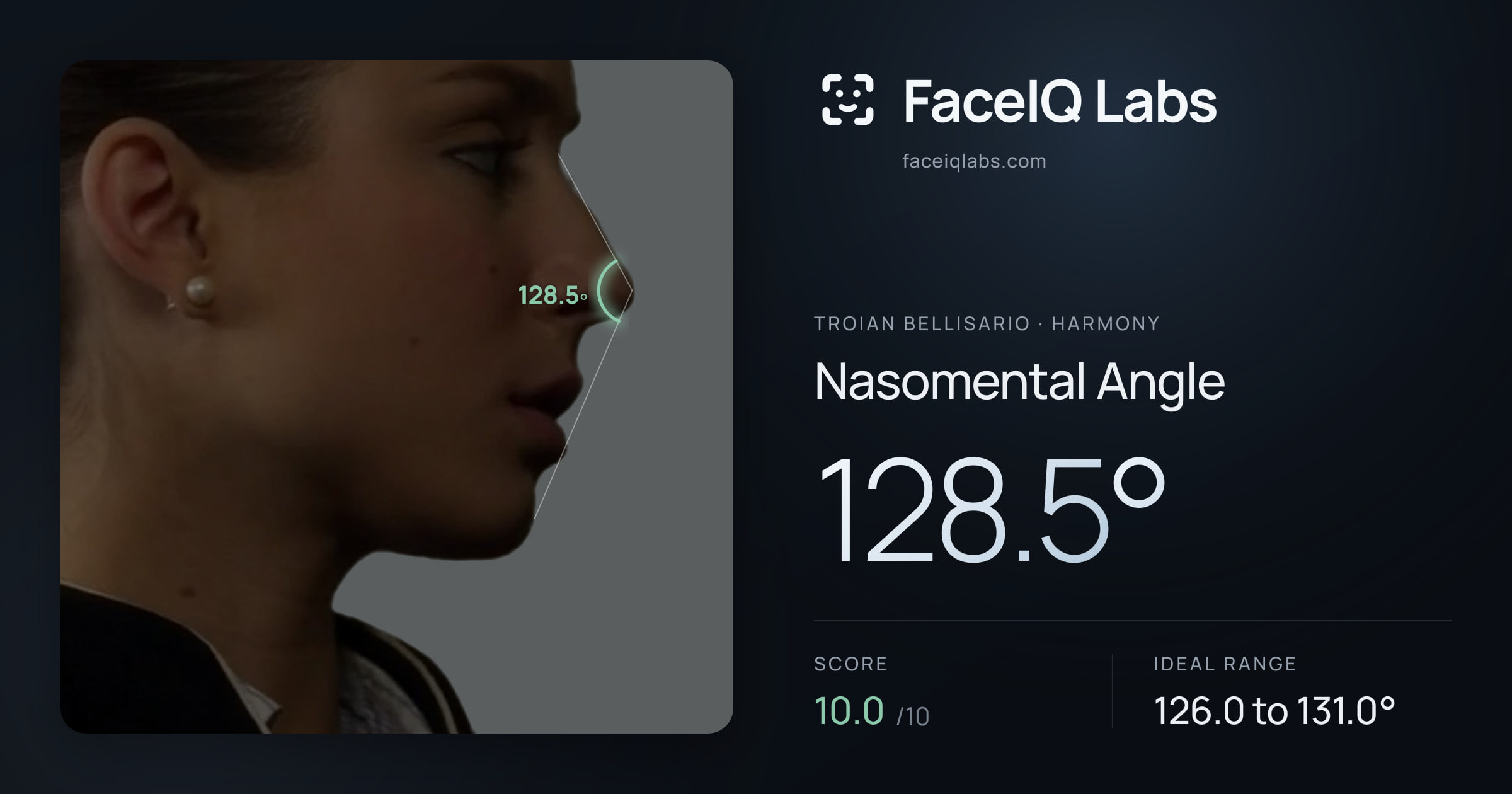 Troian Bellisario Nasomental Angle: 128.5°, drawn on the photo