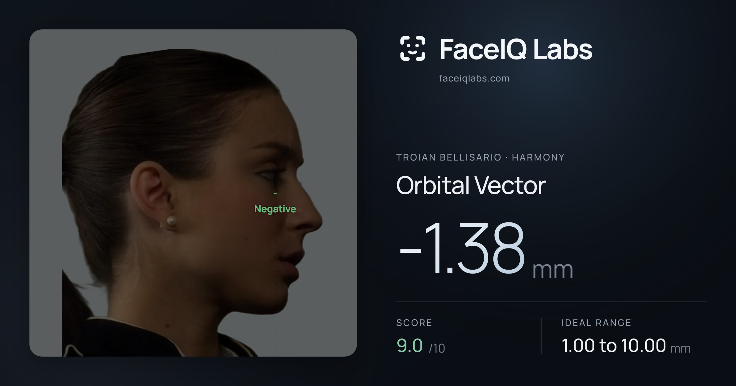 Troian Bellisario Orbital Vector: -1.38mm, drawn on the photo