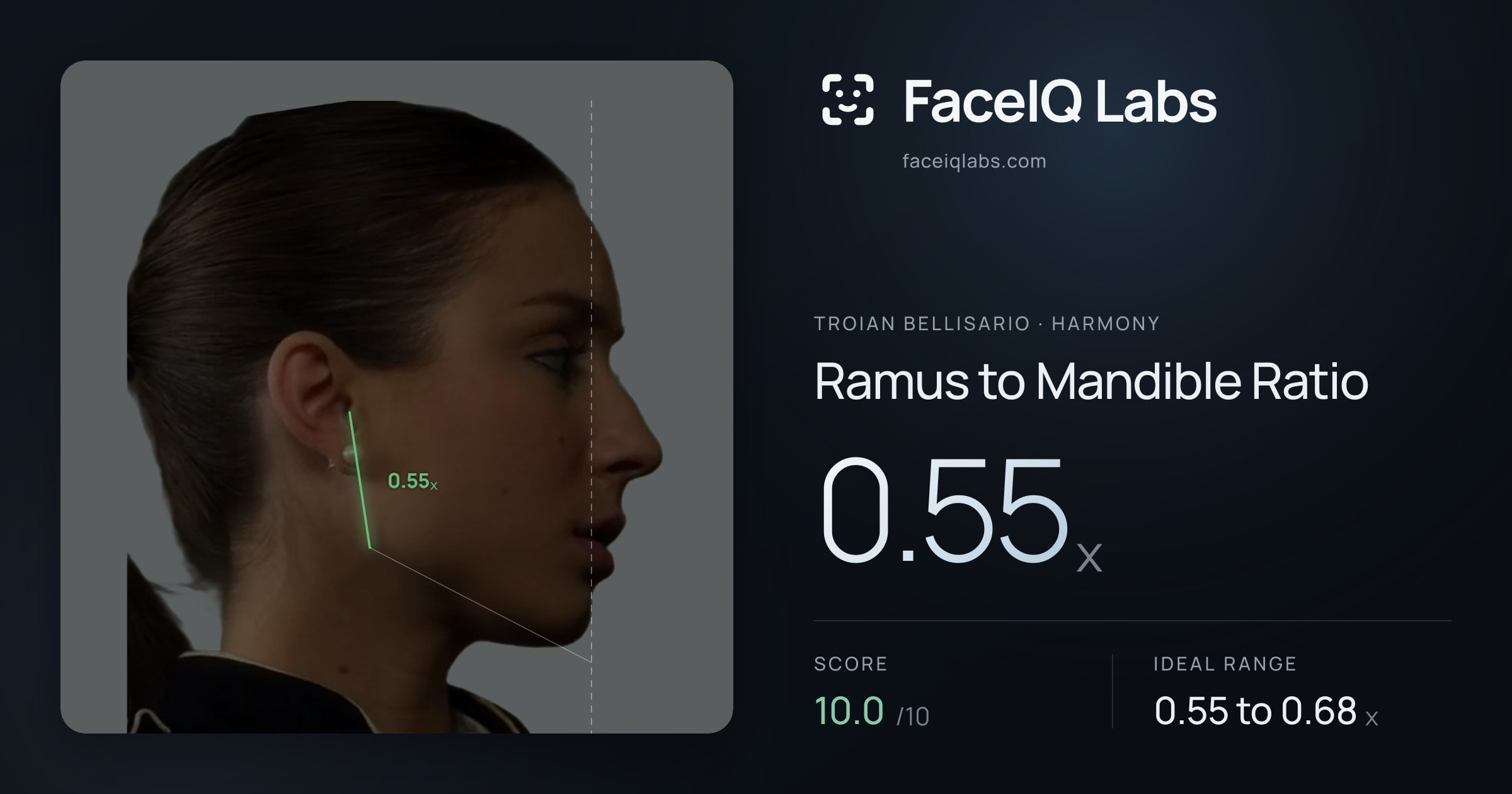 Troian Bellisario Ramus to Mandible Ratio: 0.55x, drawn on the photo