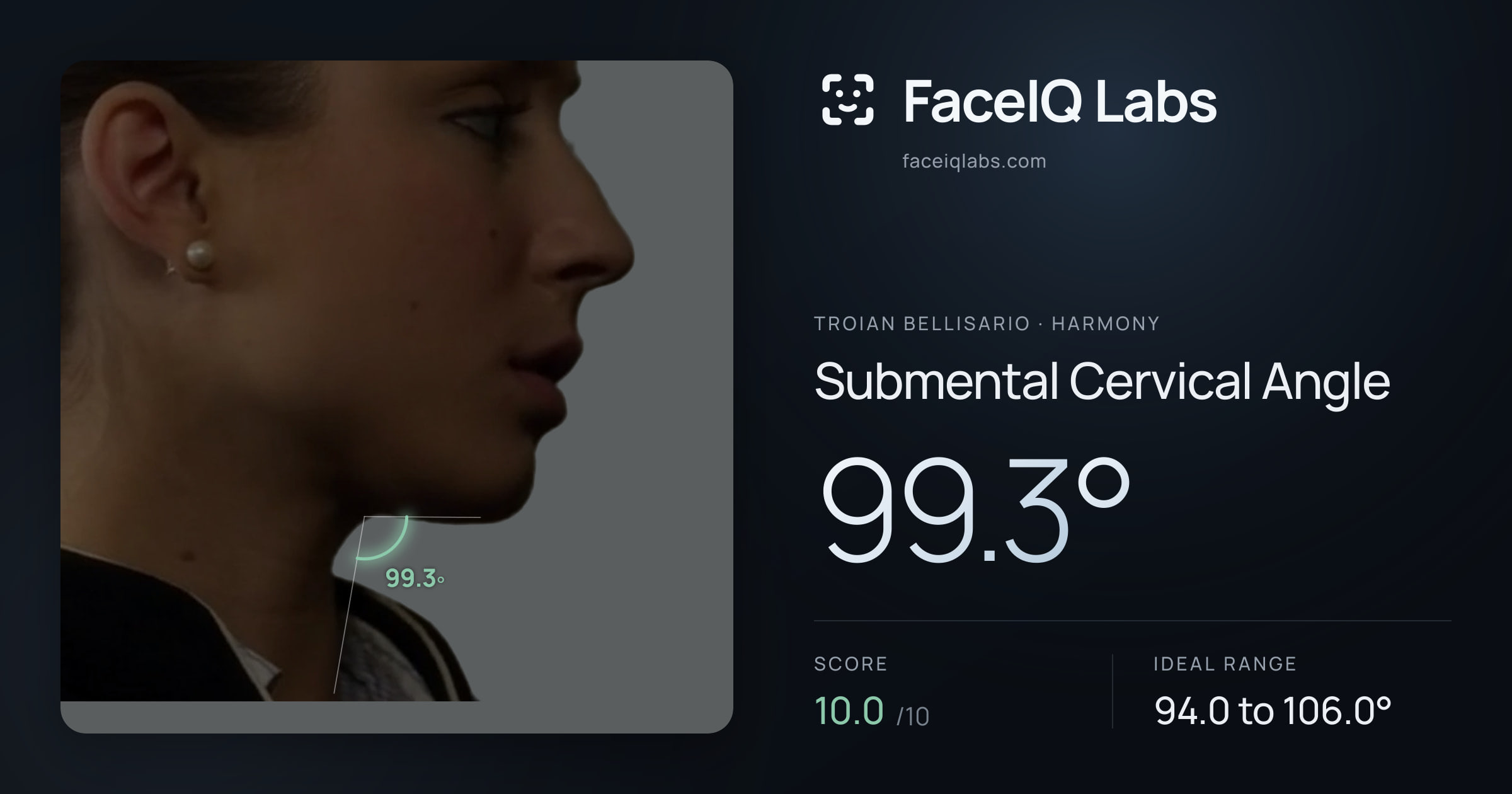 Troian Bellisario Submental Cervical Angle: 99.3°, drawn on the photo