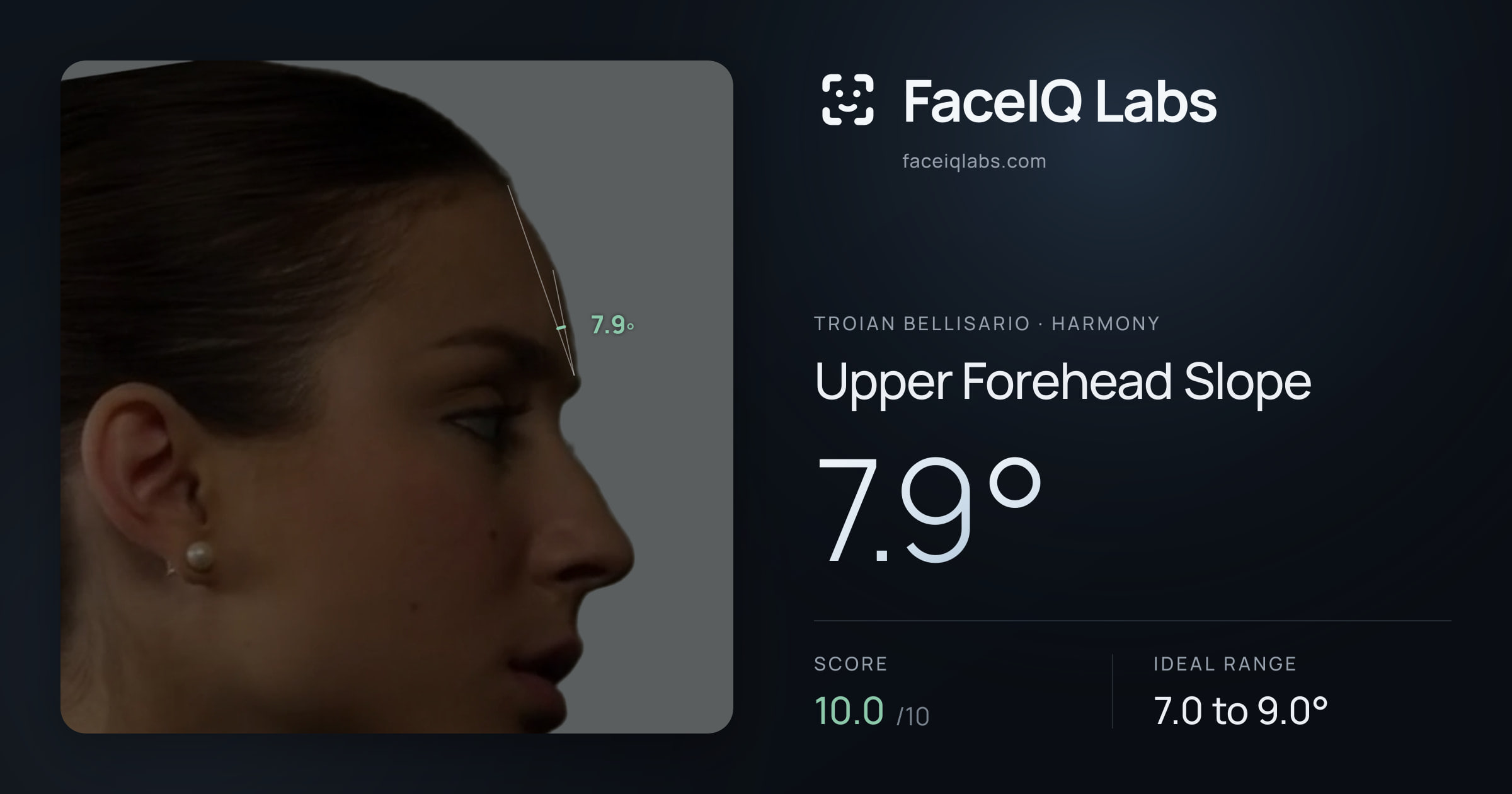 Troian Bellisario Upper Forehead Slope: 7.9°, drawn on the photo