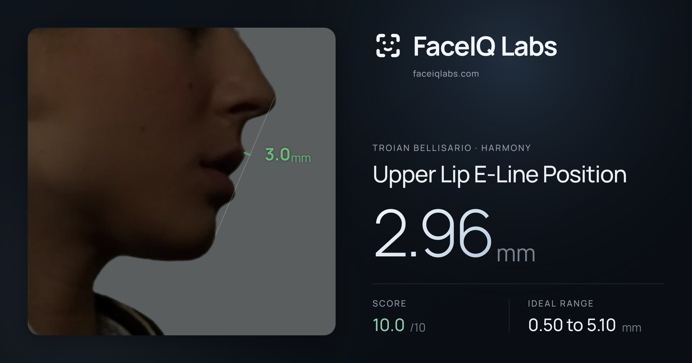 Troian Bellisario Upper Lip E-Line Position: 2.96mm, drawn on the photo