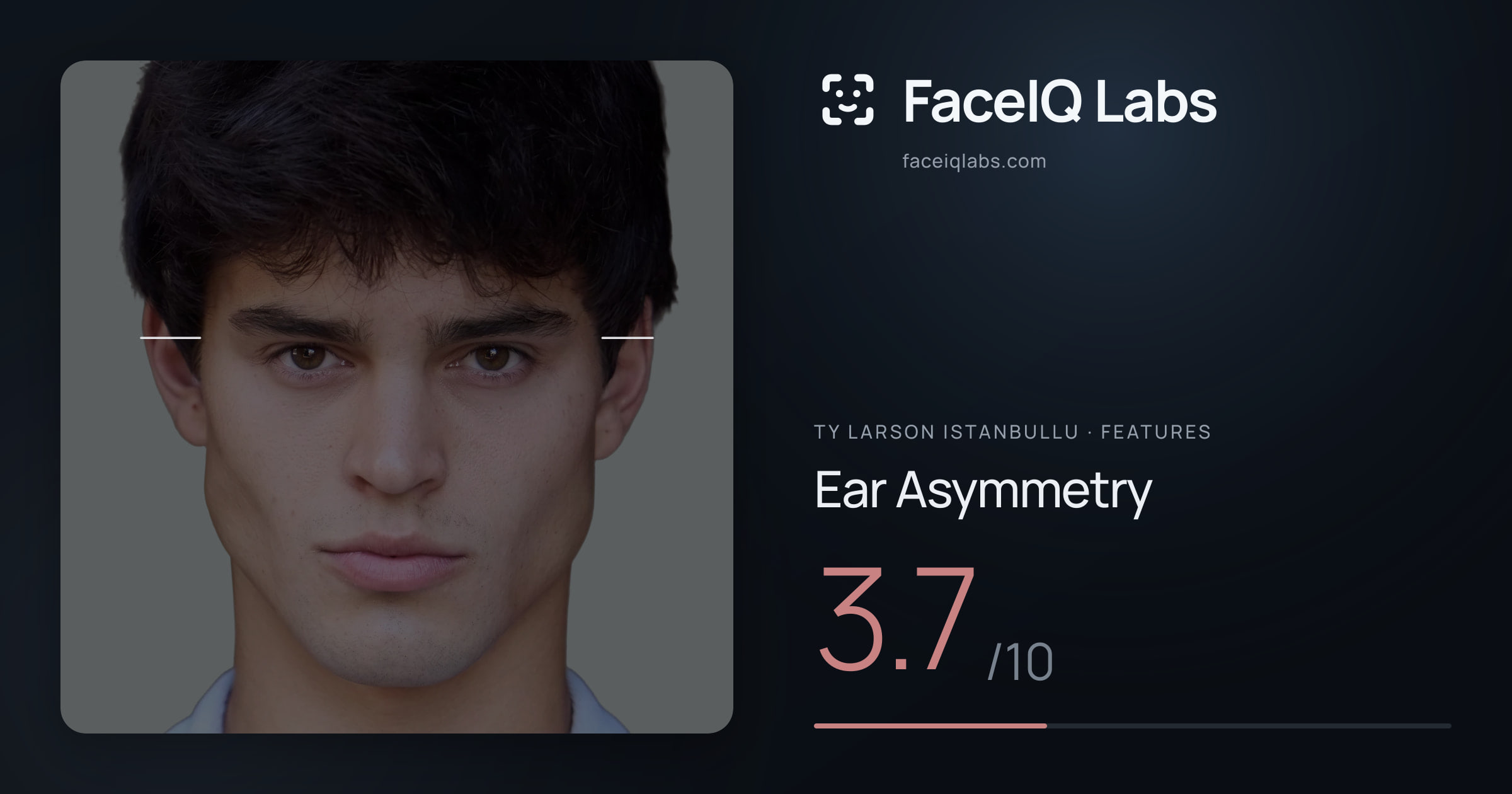 Ty Larson Istanbullu Ear Asymmetry: 3.7/10, drawn on the photo