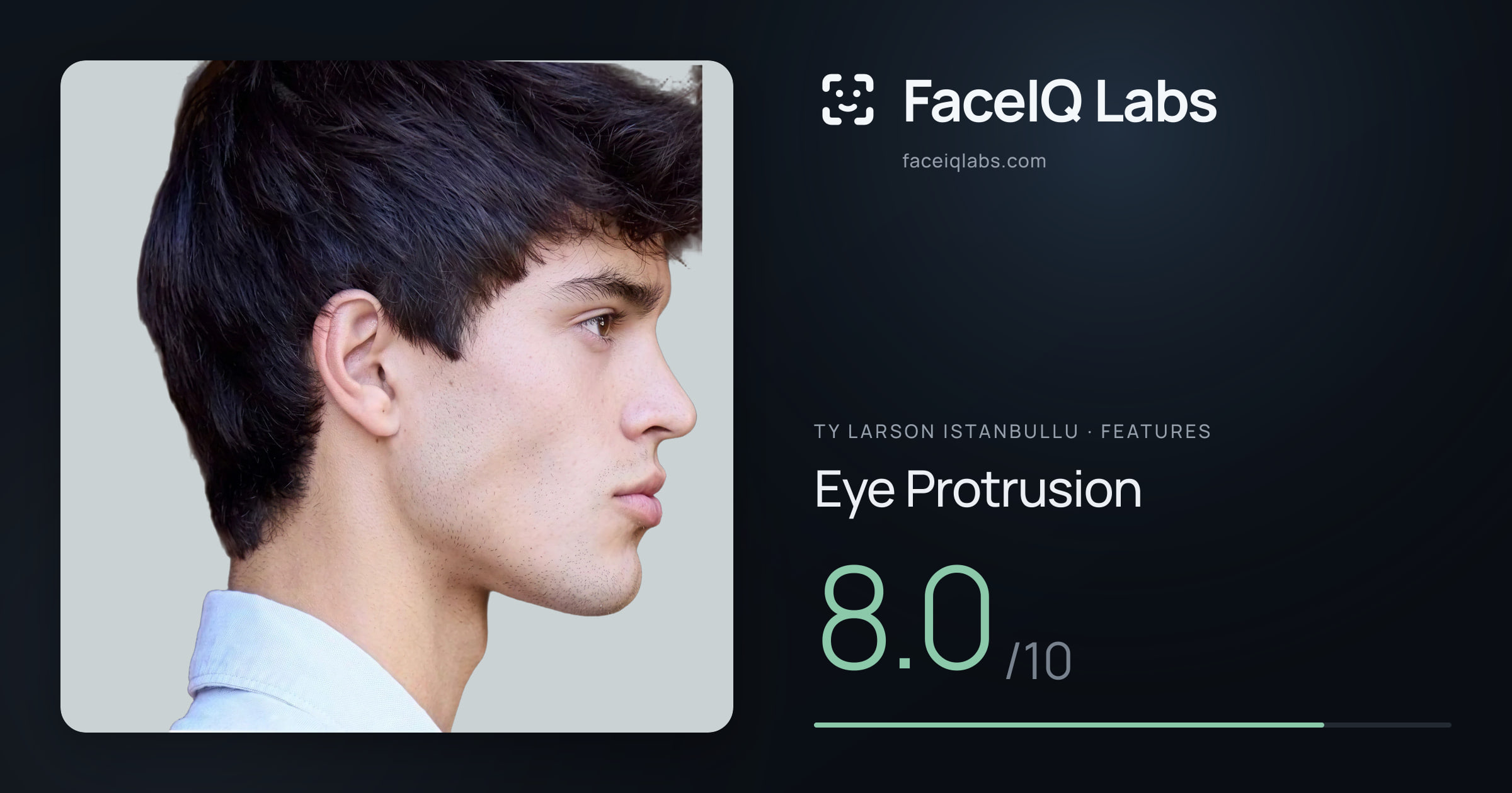 Ty Larson Istanbullu Eye Protrusion: 8.0/10, drawn on the photo