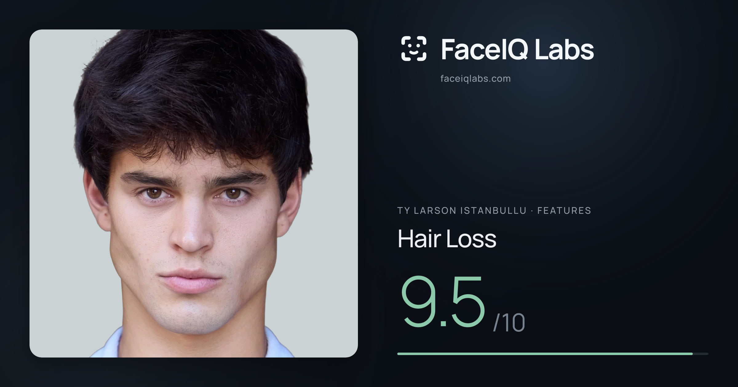 Ty Larson Istanbullu Hair Loss: 9.5/10, drawn on the photo