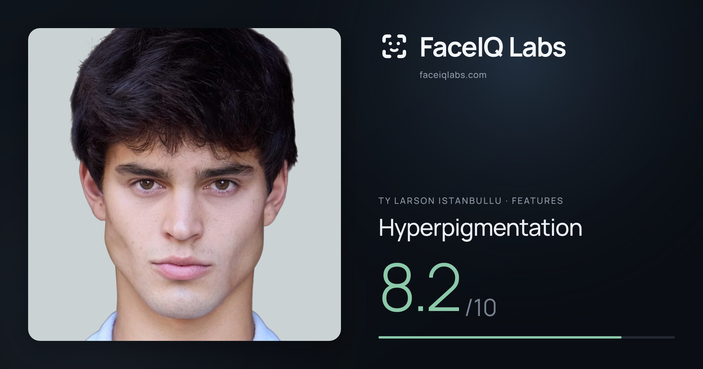 Ty Larson Istanbullu Hyperpigmentation: 8.2/10, drawn on the photo