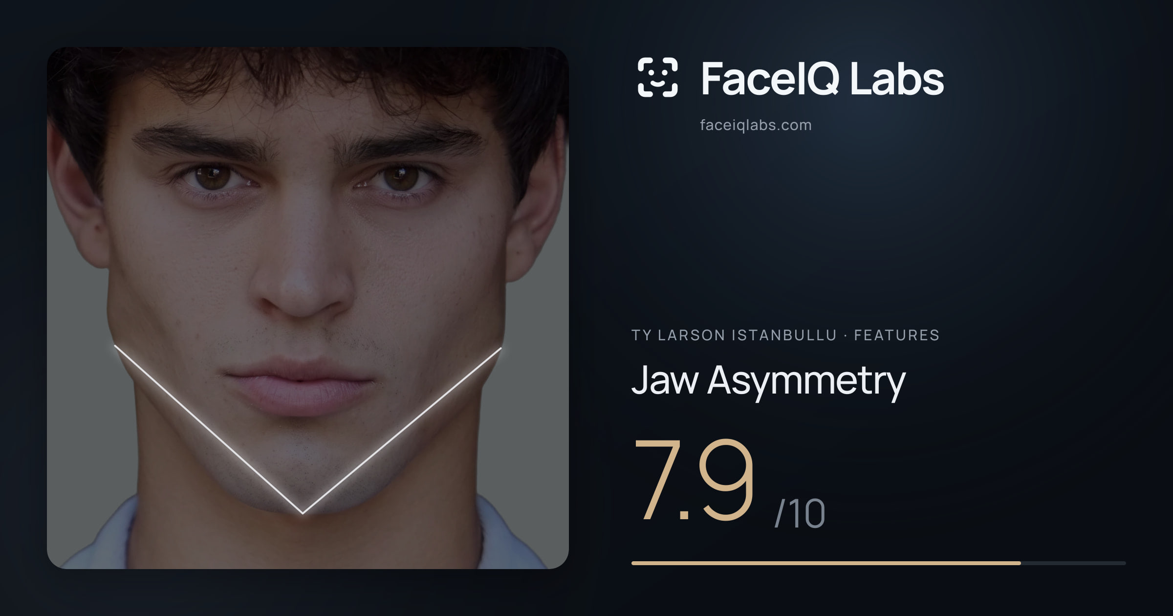 Ty Larson Istanbullu Jaw Asymmetry: 7.9/10, drawn on the photo