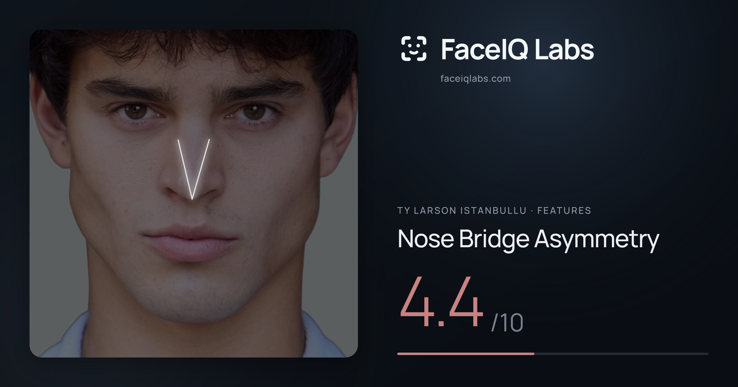 Ty Larson Istanbullu Nose Bridge Asymmetry: 4.4/10, drawn on the photo