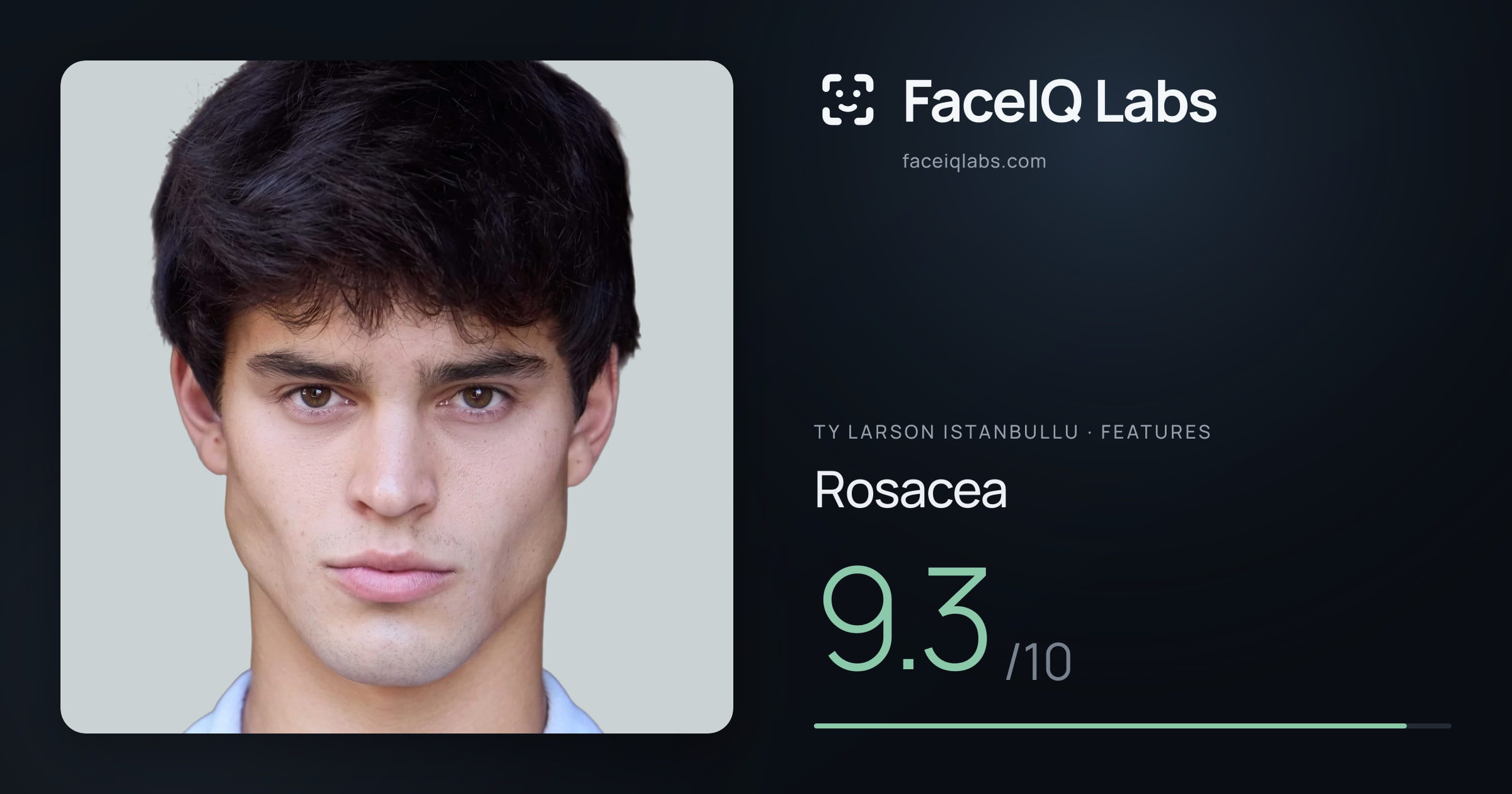 Ty Larson Istanbullu Rosacea: 9.3/10, drawn on the photo