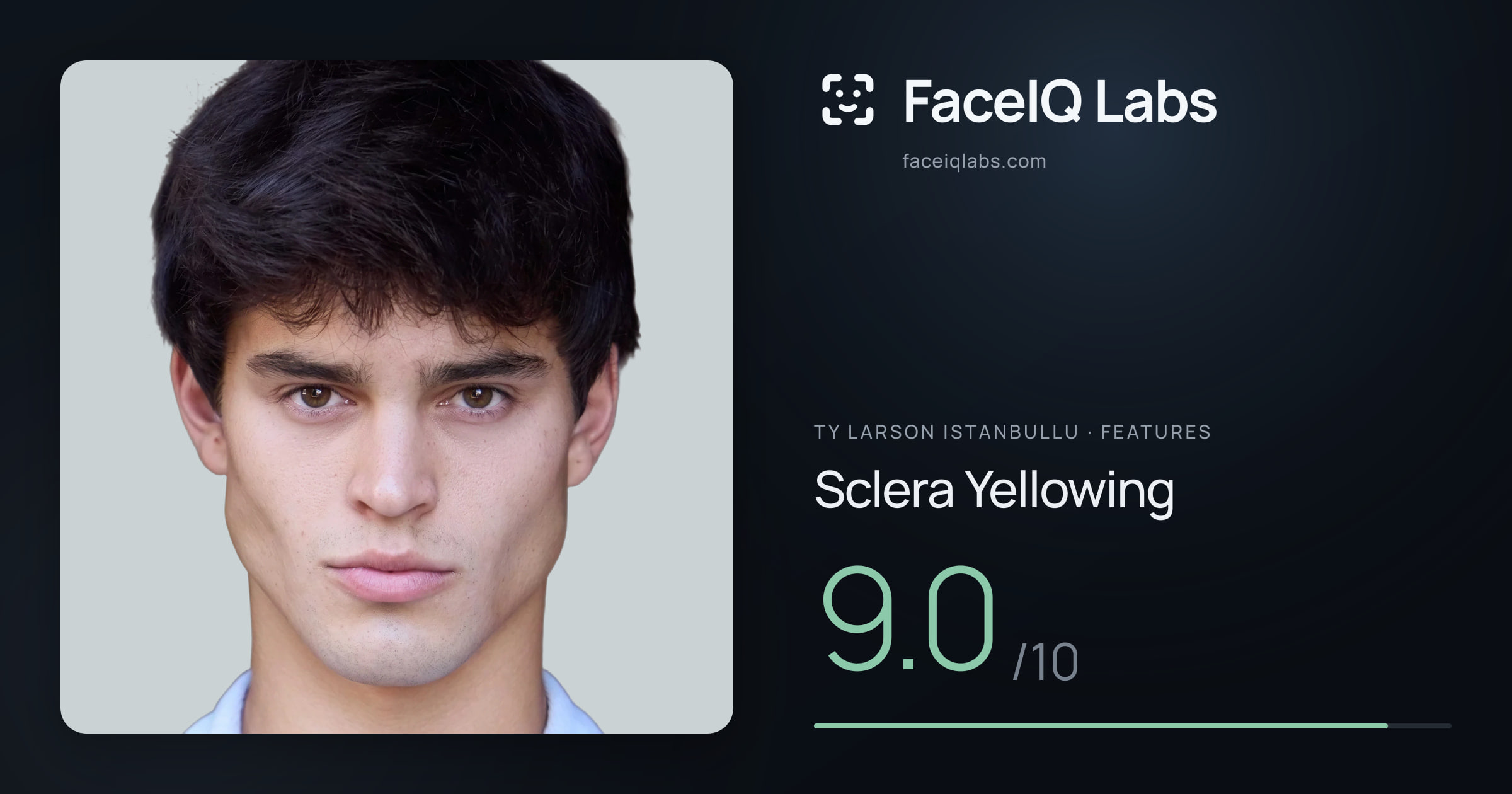 Ty Larson Istanbullu Sclera Yellowing: 9.0/10, drawn on the photo