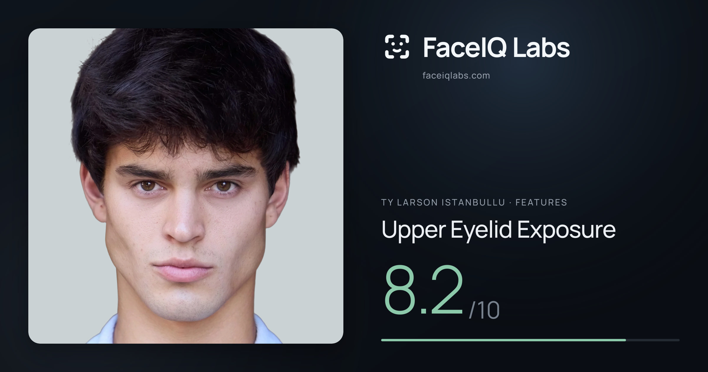 Ty Larson Istanbullu Upper Eyelid Exposure: 8.2/10, drawn on the photo
