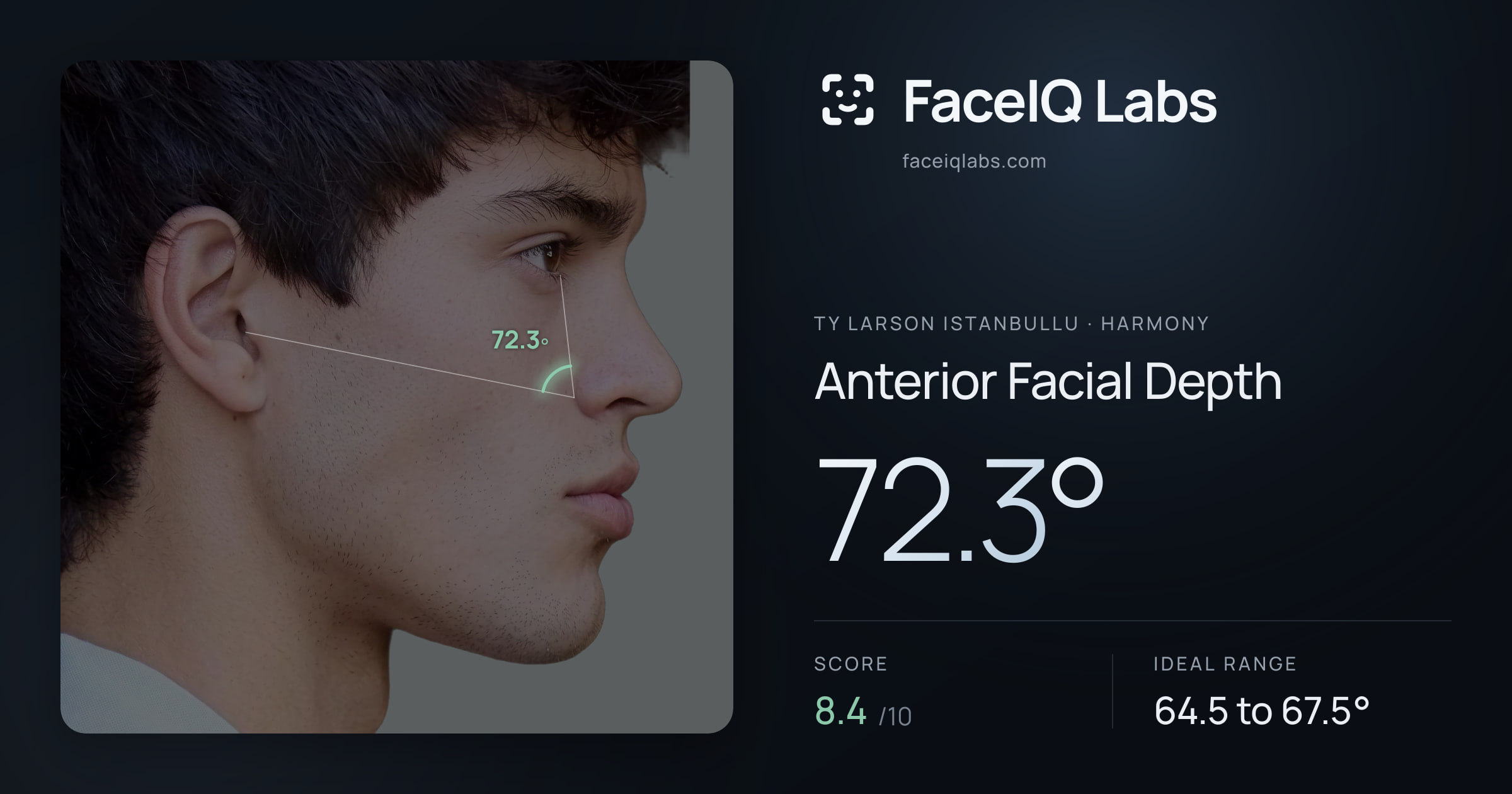 Ty Larson Istanbullu Anterior Facial Depth: 72.3°, drawn on the photo