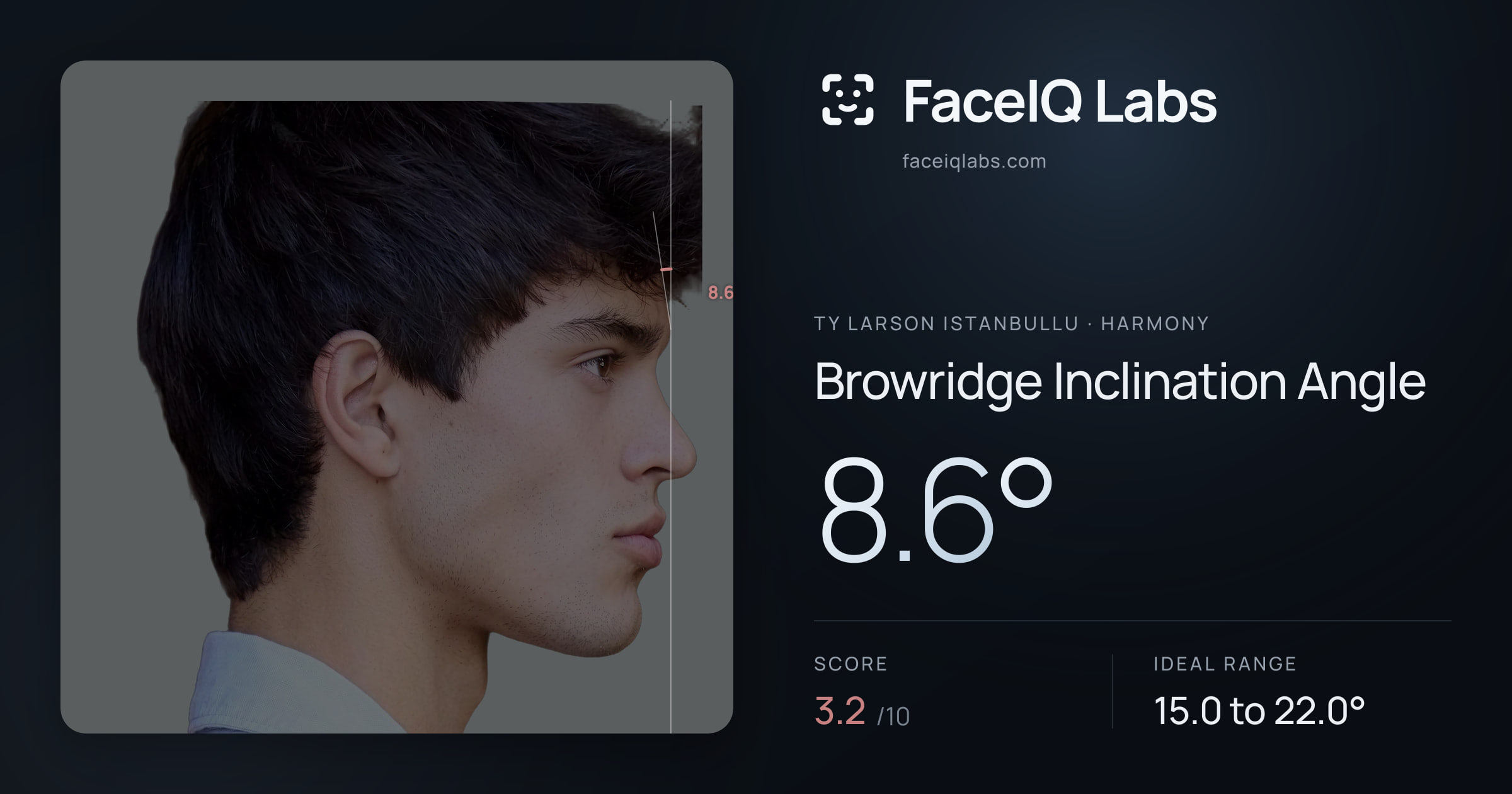 Ty Larson Istanbullu Browridge Inclination Angle: 8.6°, drawn on the photo
